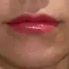 後
