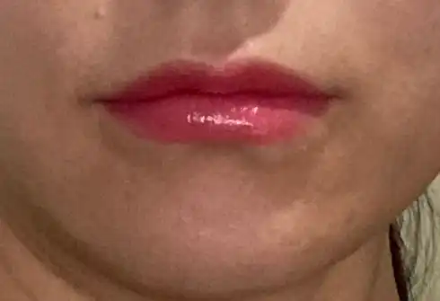 후