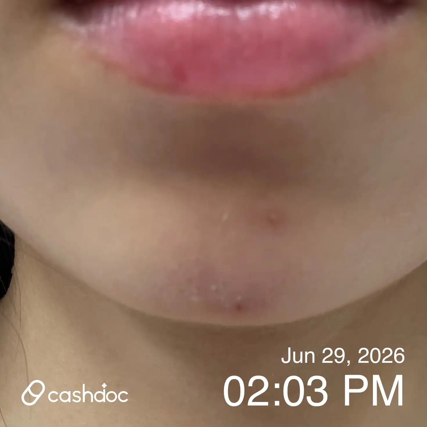 Review photo