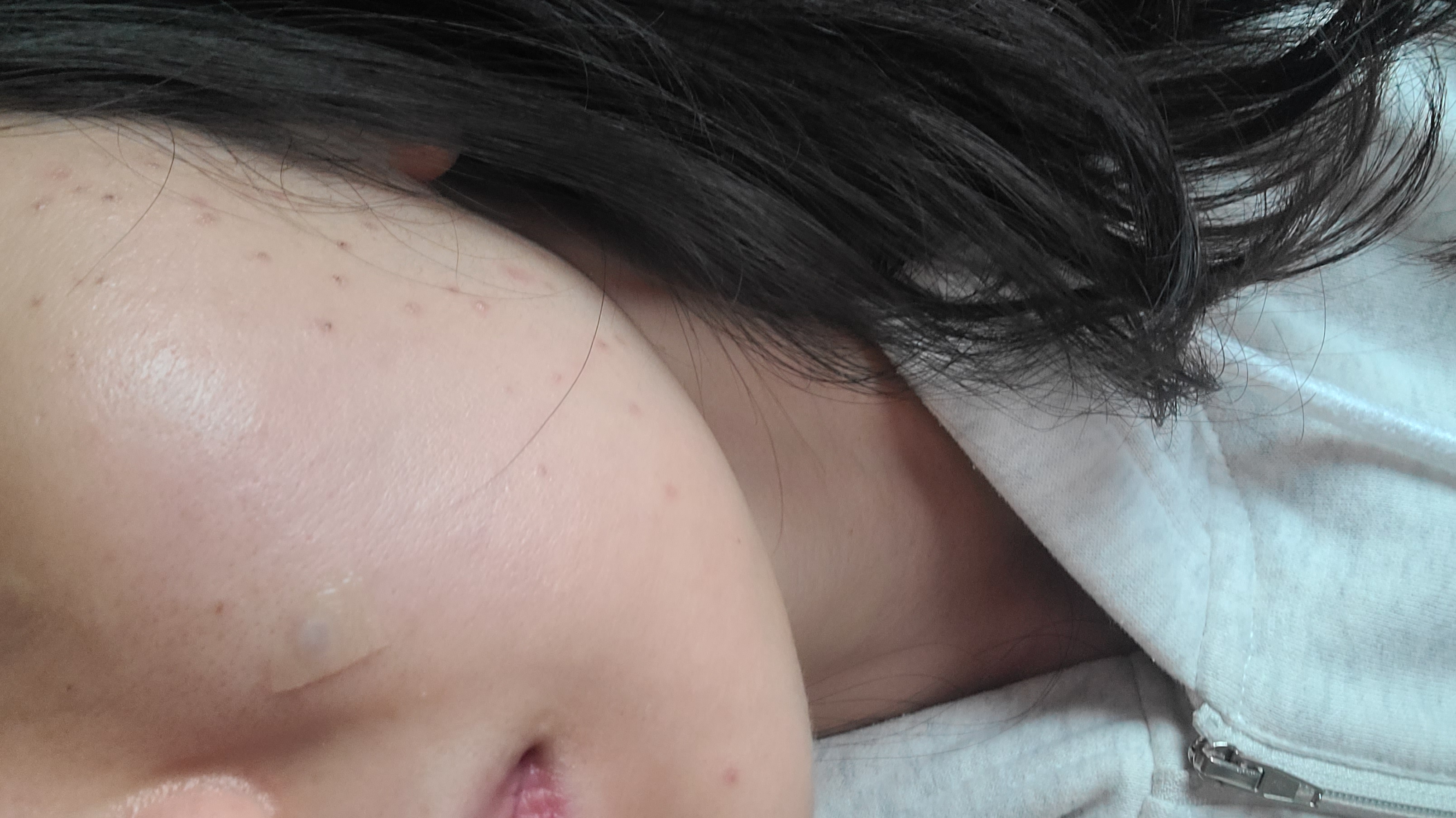 After