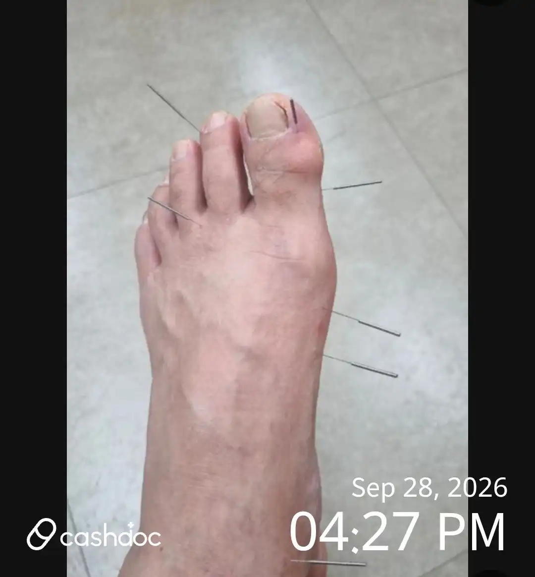 评价照片
