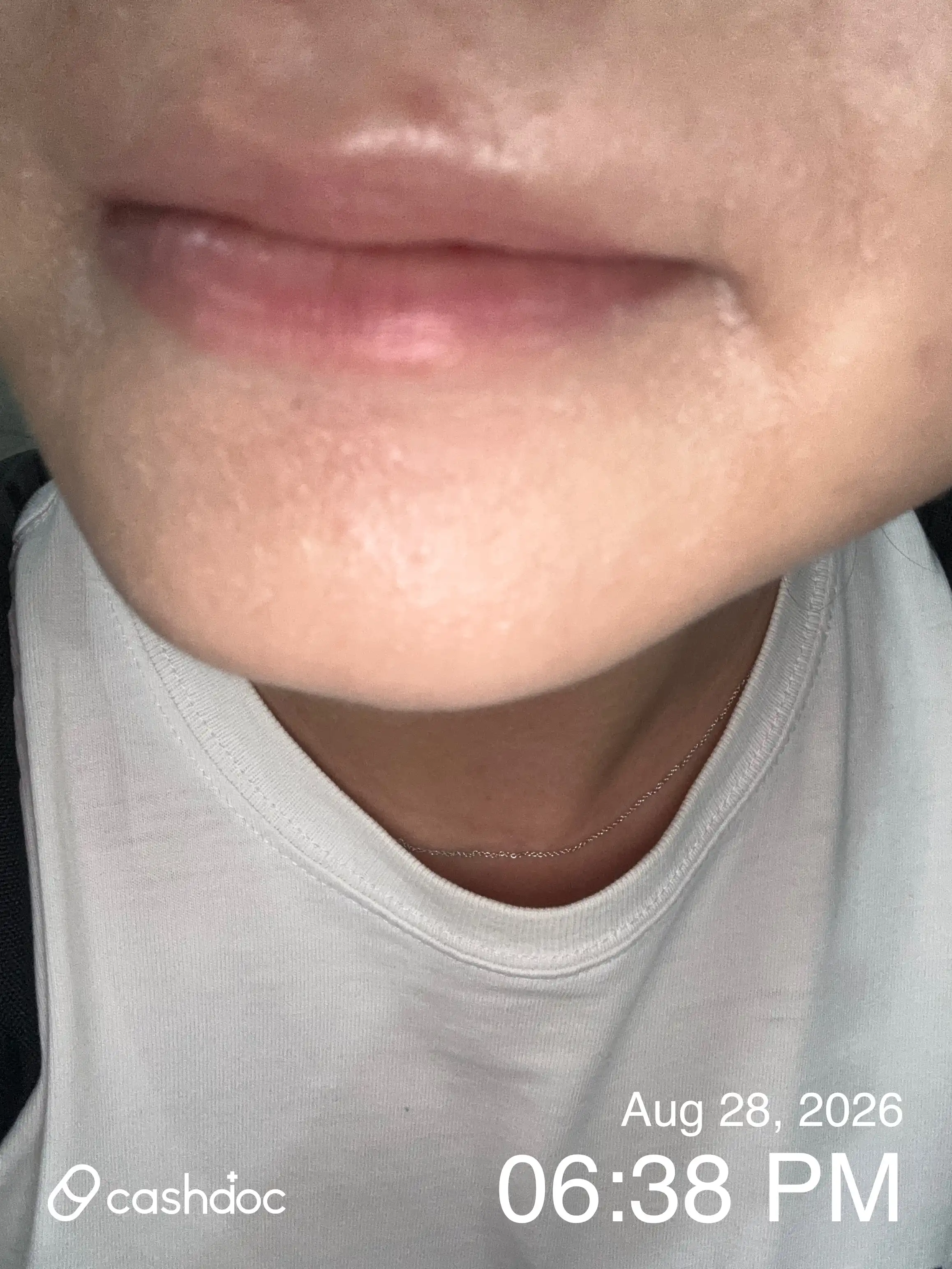 评价照片