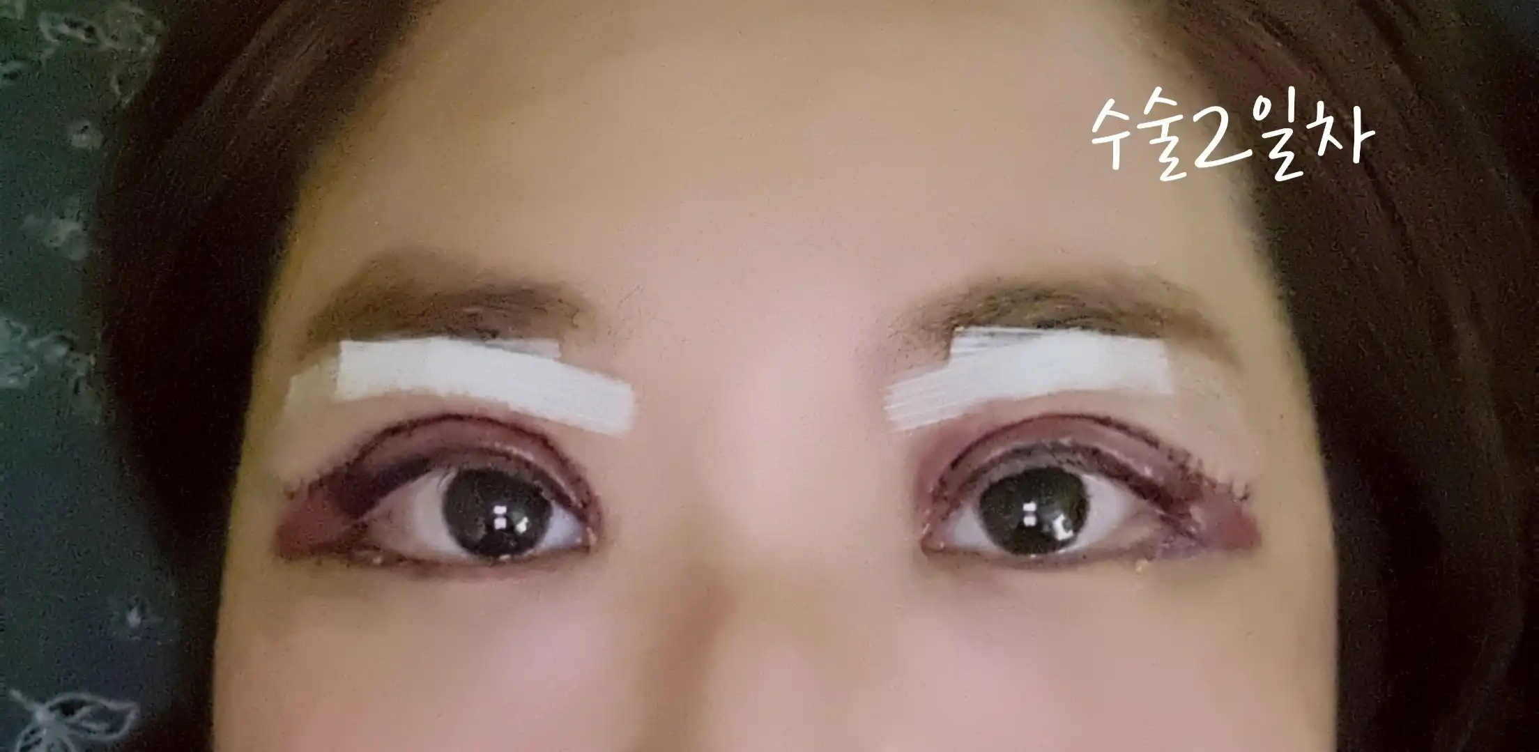후