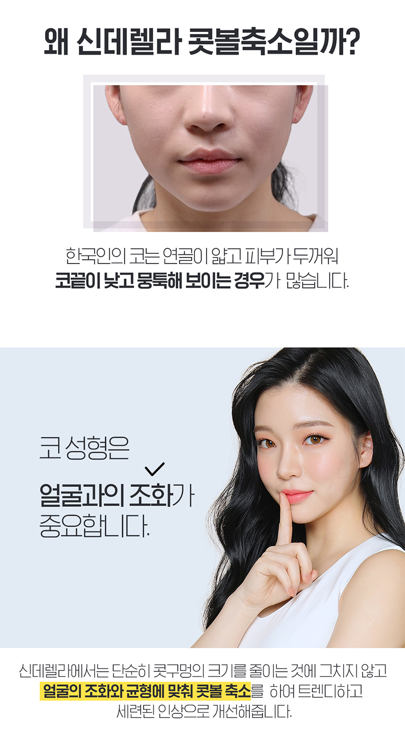 신데렐라성형외과의원 ❤신데렐라 콧볼축소❤ 이벤트, 시술 상세 이미지