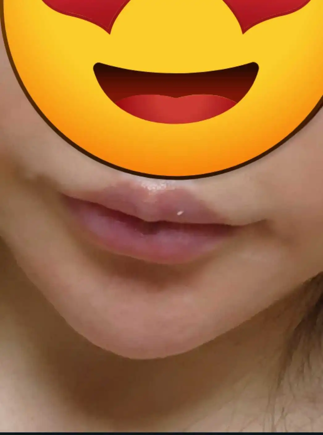 후