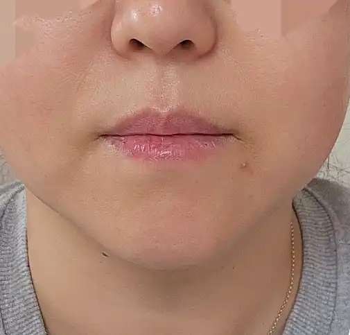 후