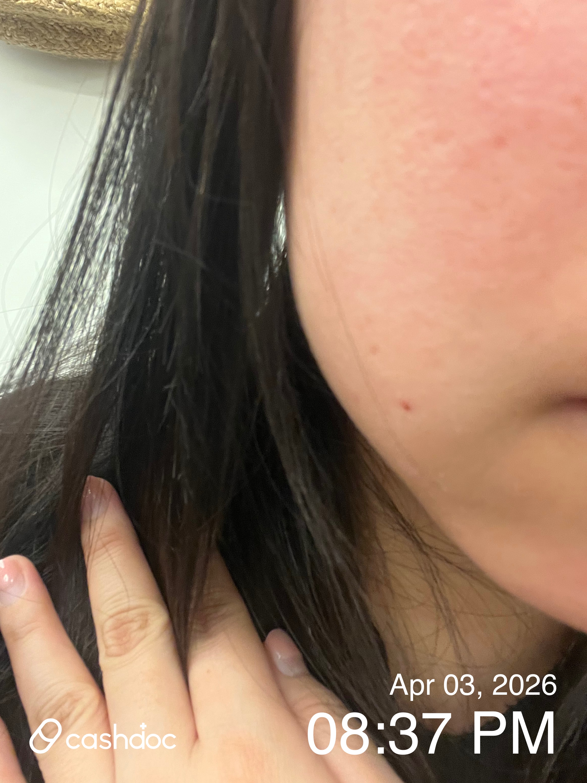 유성구 아이워너비의원, 조민기 원장님 시술에 만족!