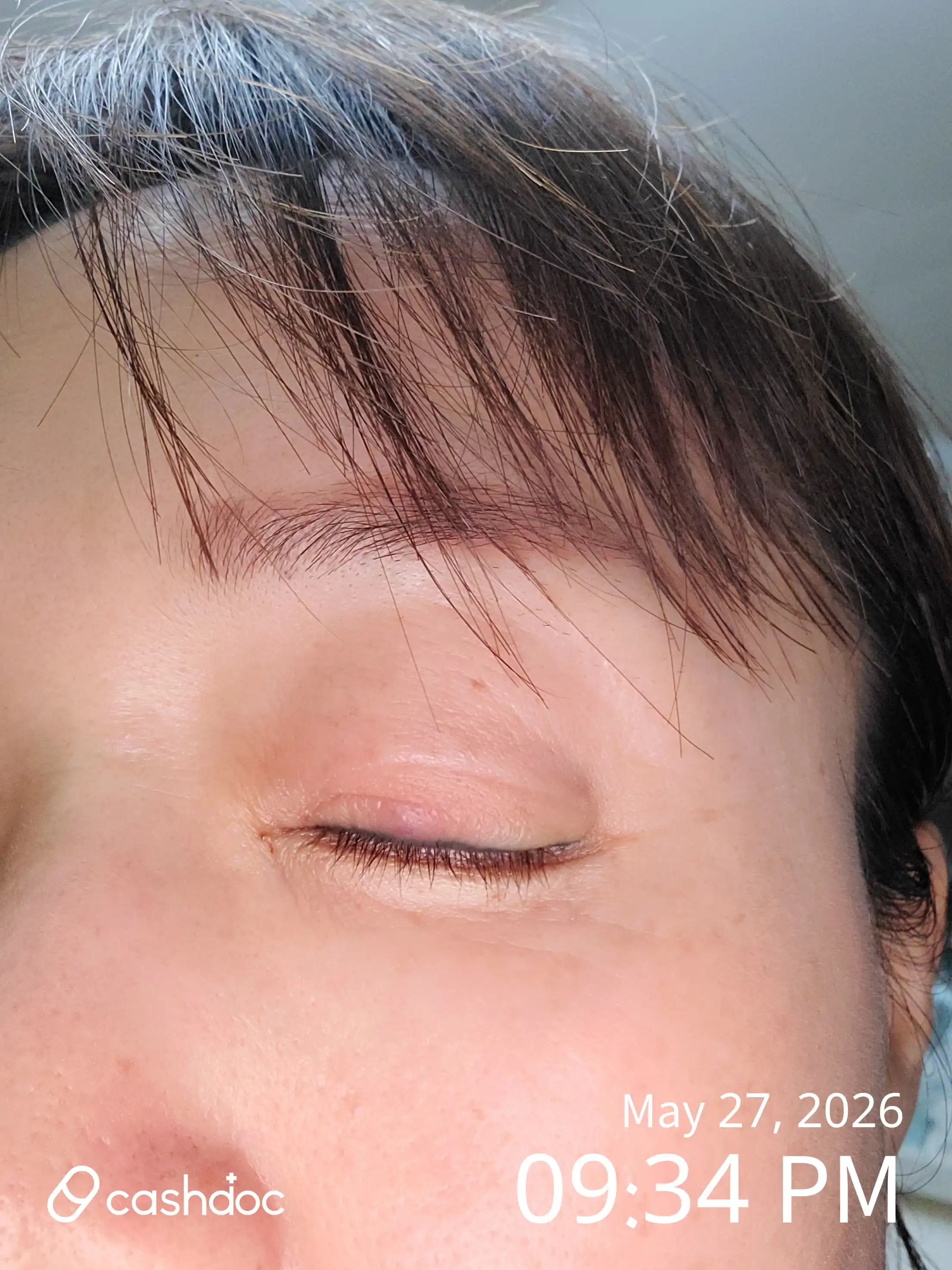 Suji Seoul Eye Clinic review photo