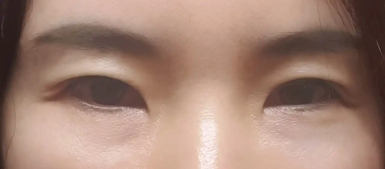 전