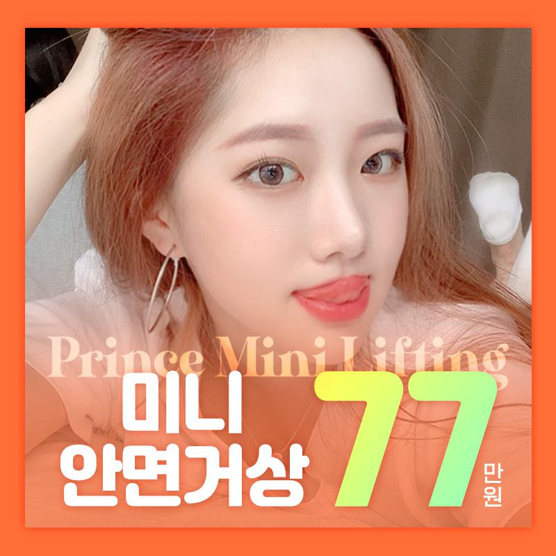프린스 미니 안면거상 이벤트 썸네일 이미지