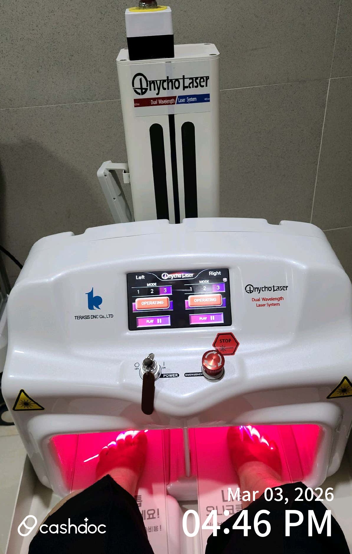 성남시 메디원의원에서 체계적인 무좀 레이저 치료 경험!