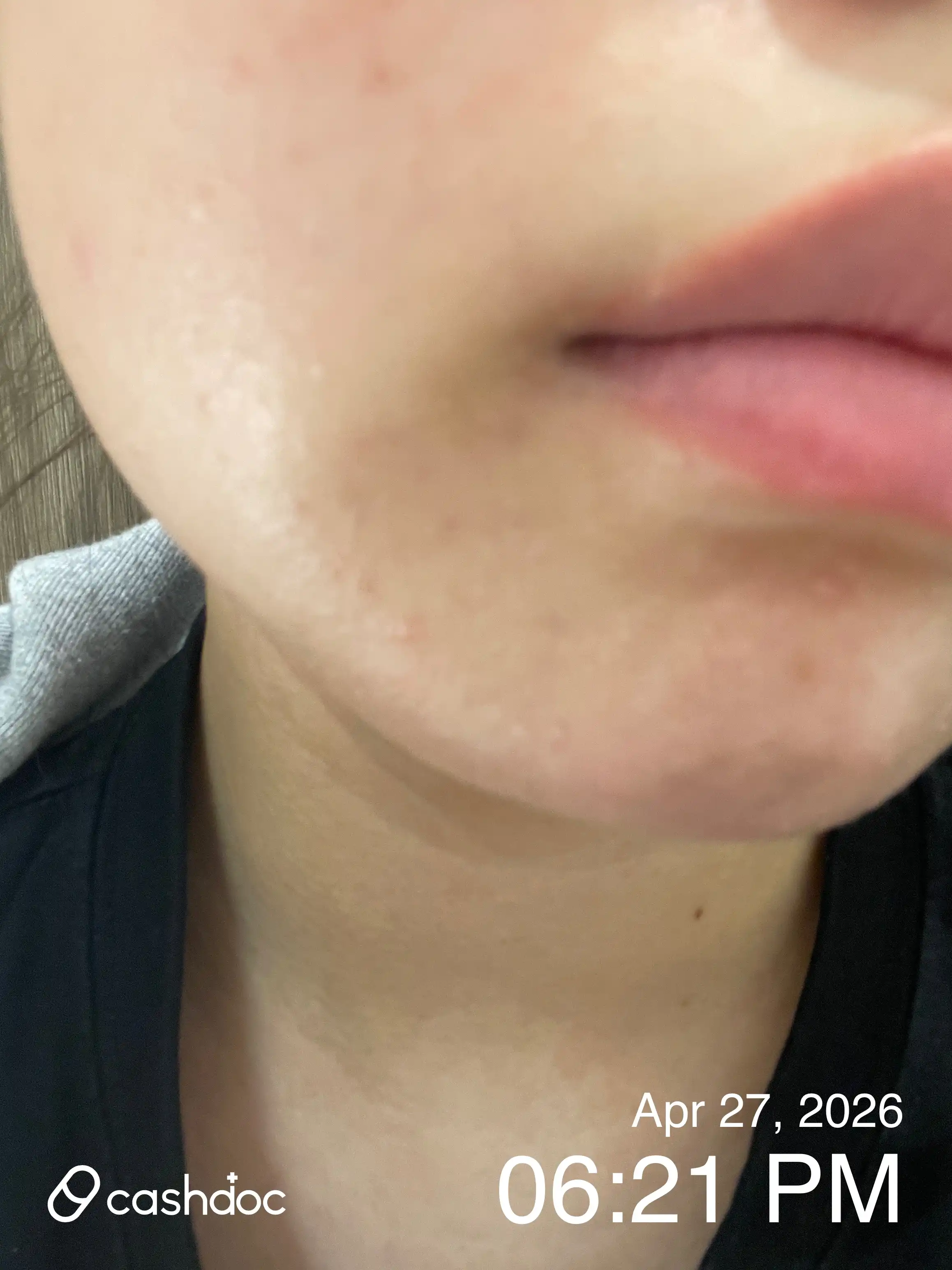 评价照片