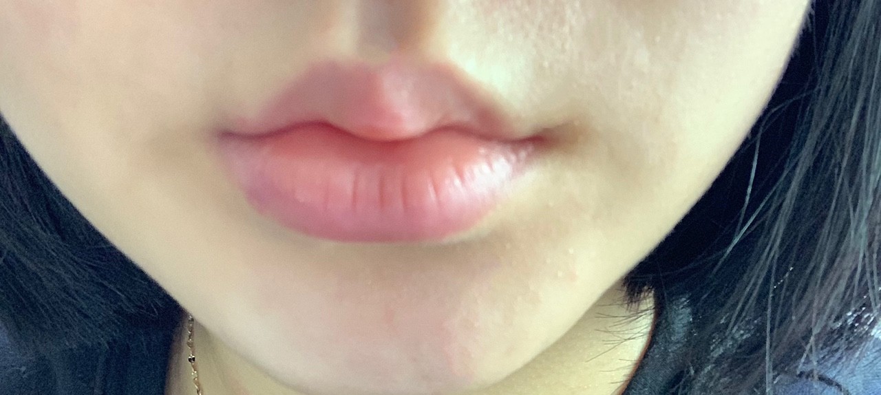 After