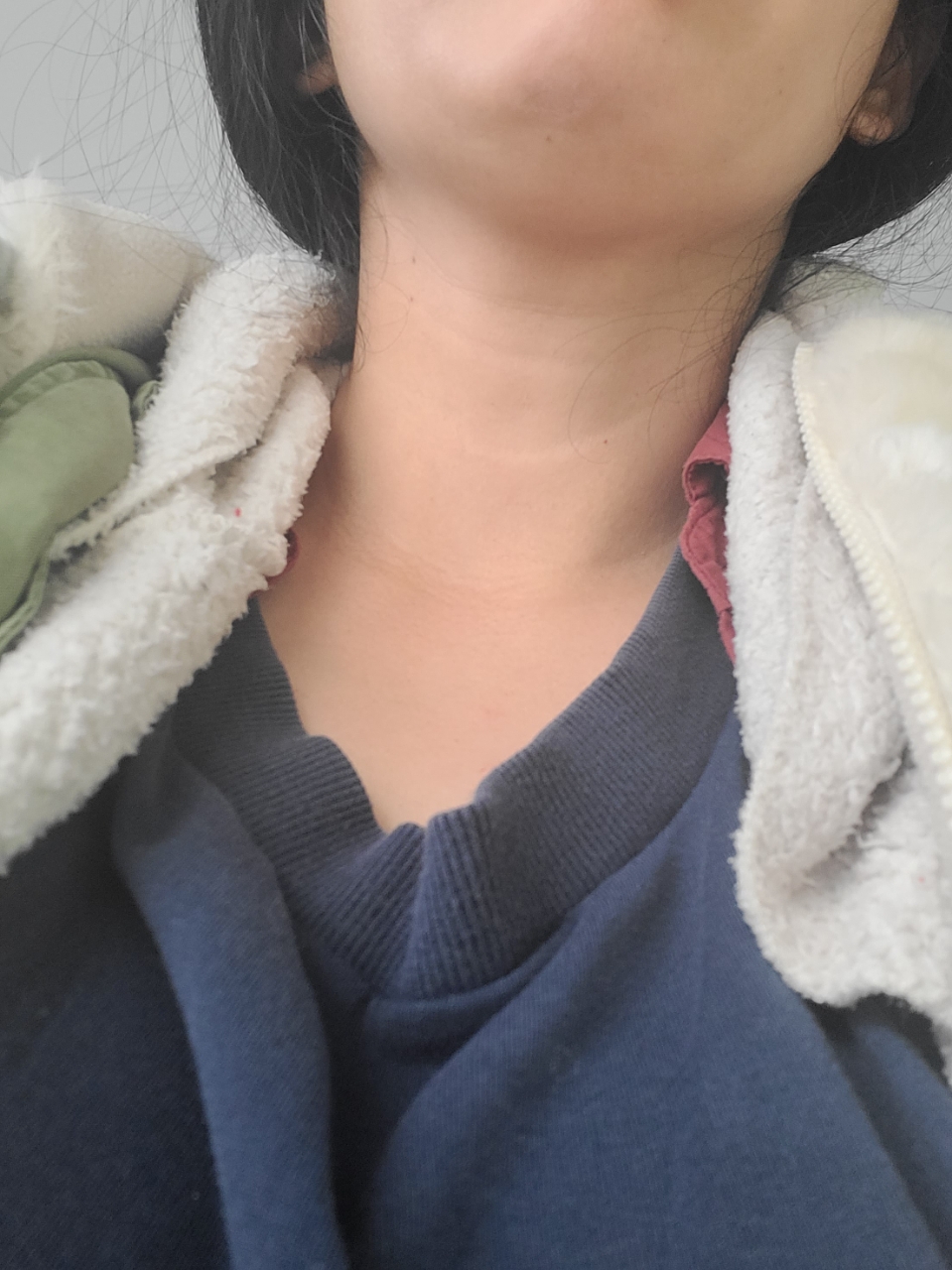 Before