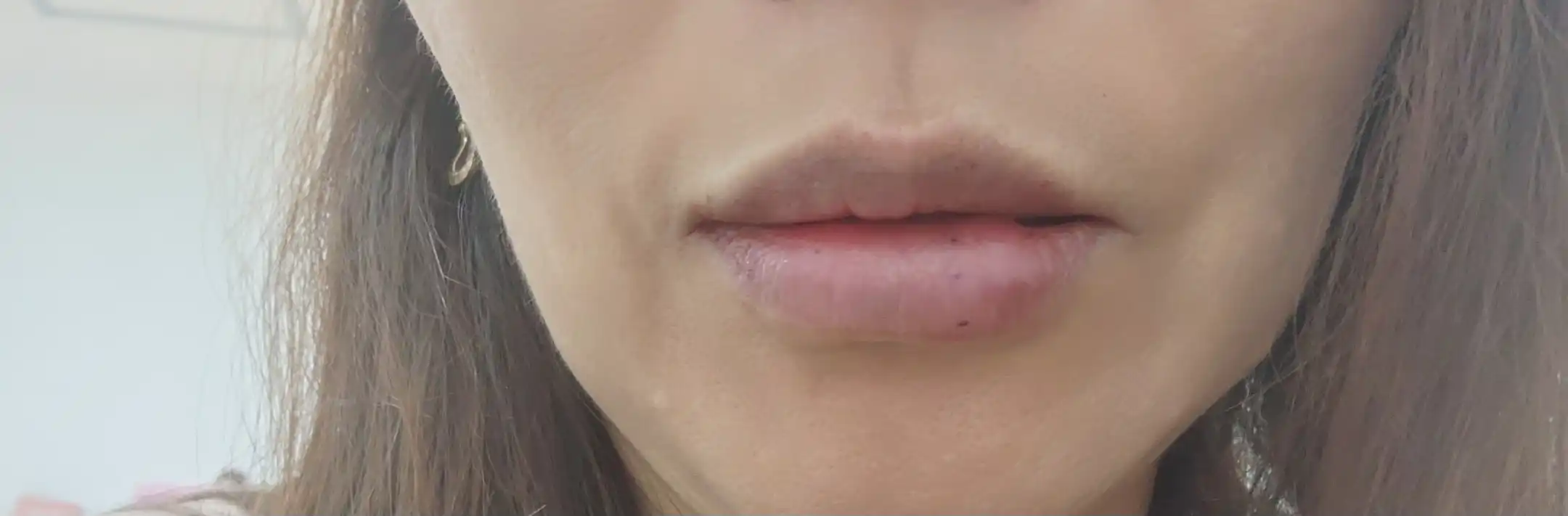 후