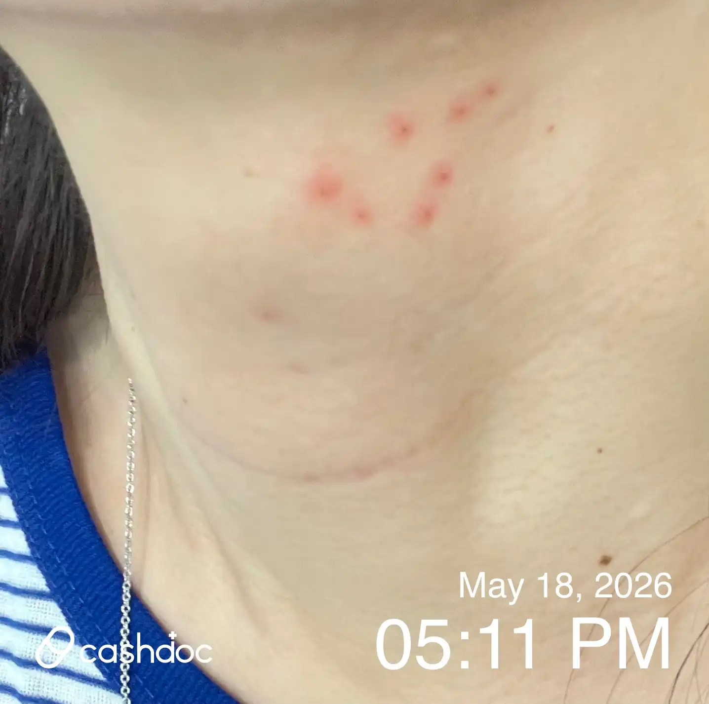 Review photo