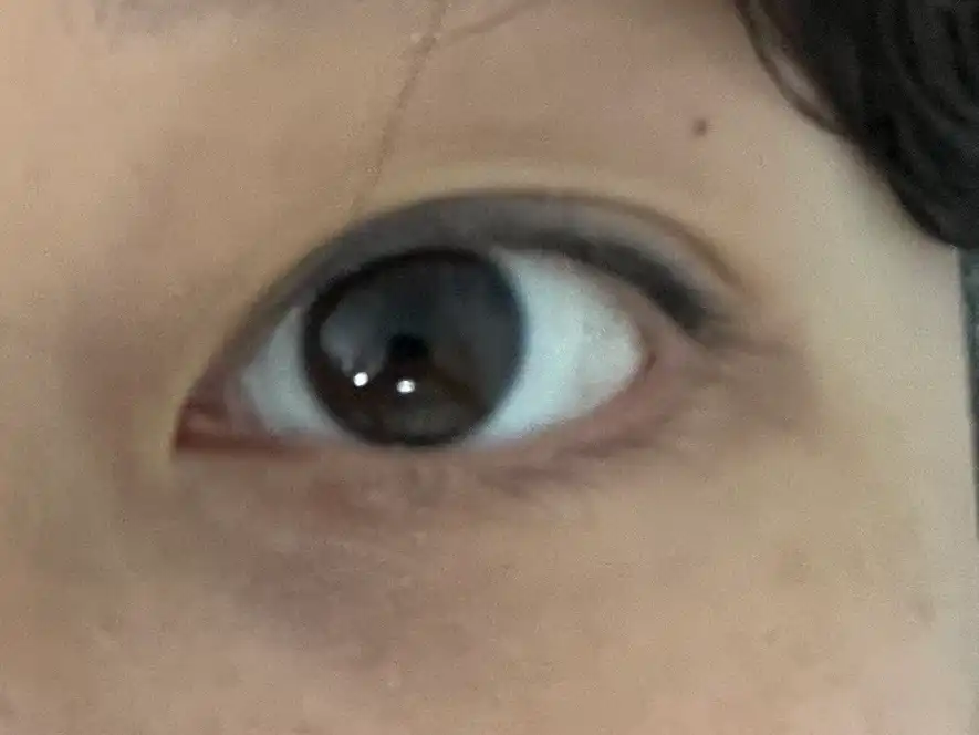 후