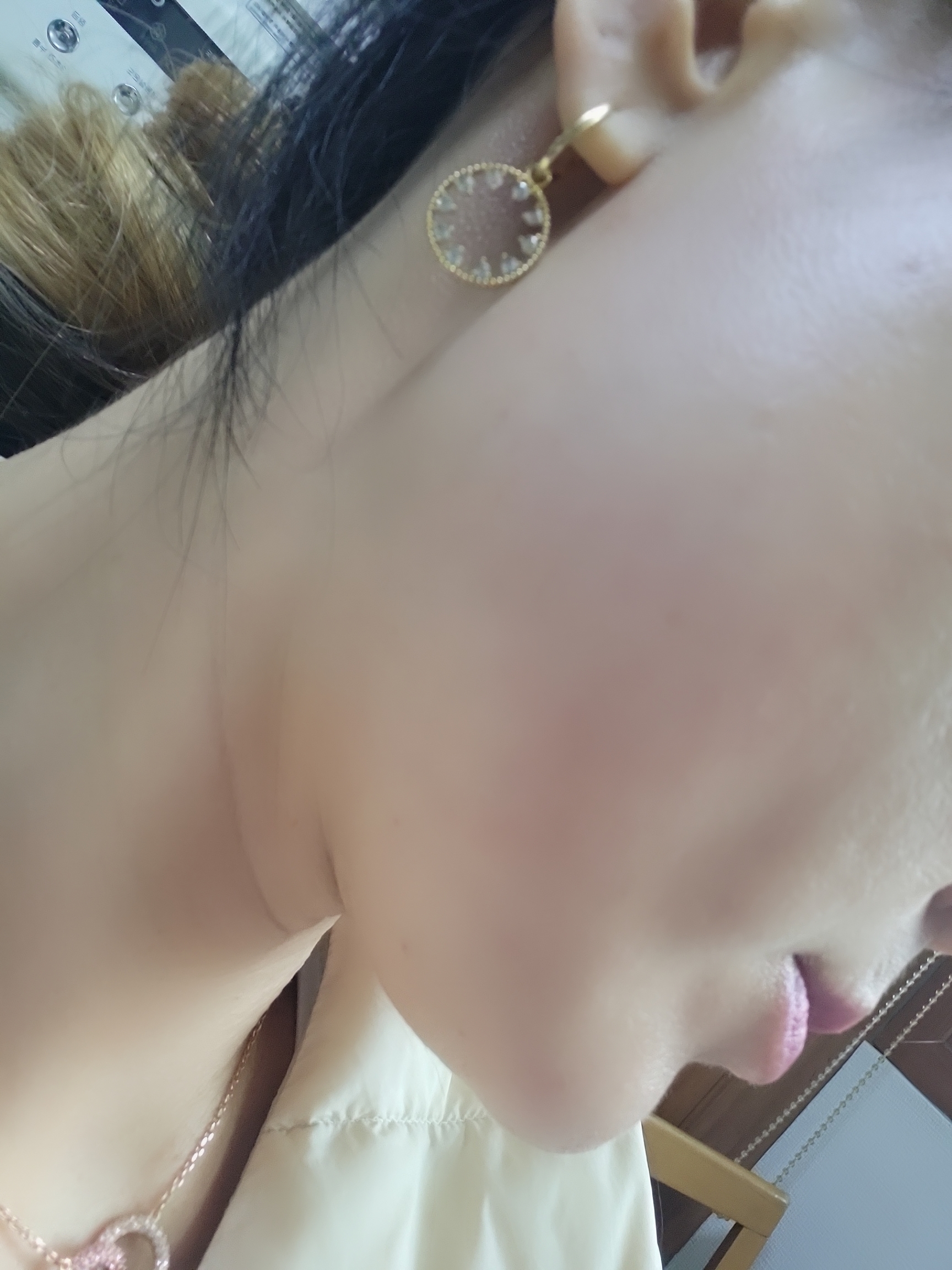 안양 톡스앤필의원에서 첫 사각턱 보톡스, 결과 만족스러워요