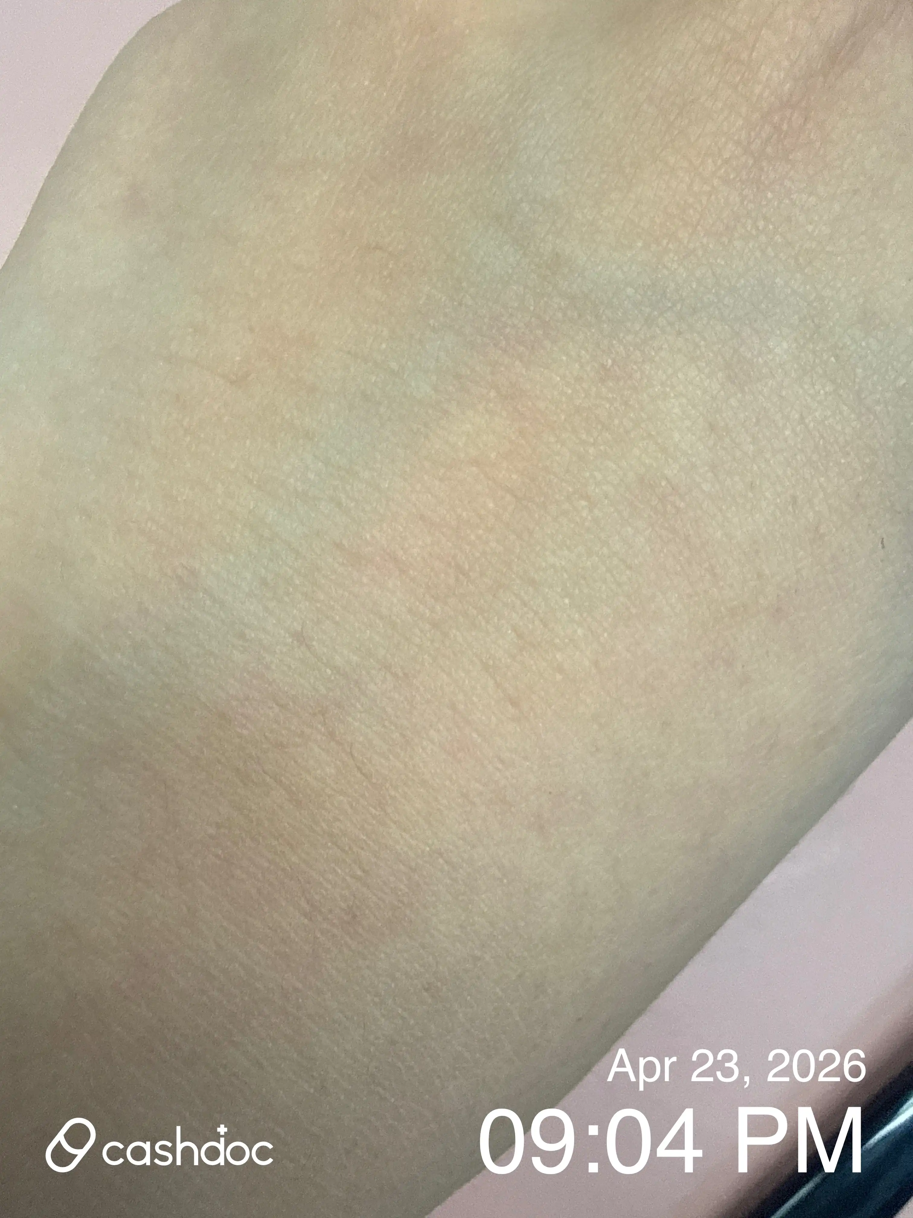 Review photo