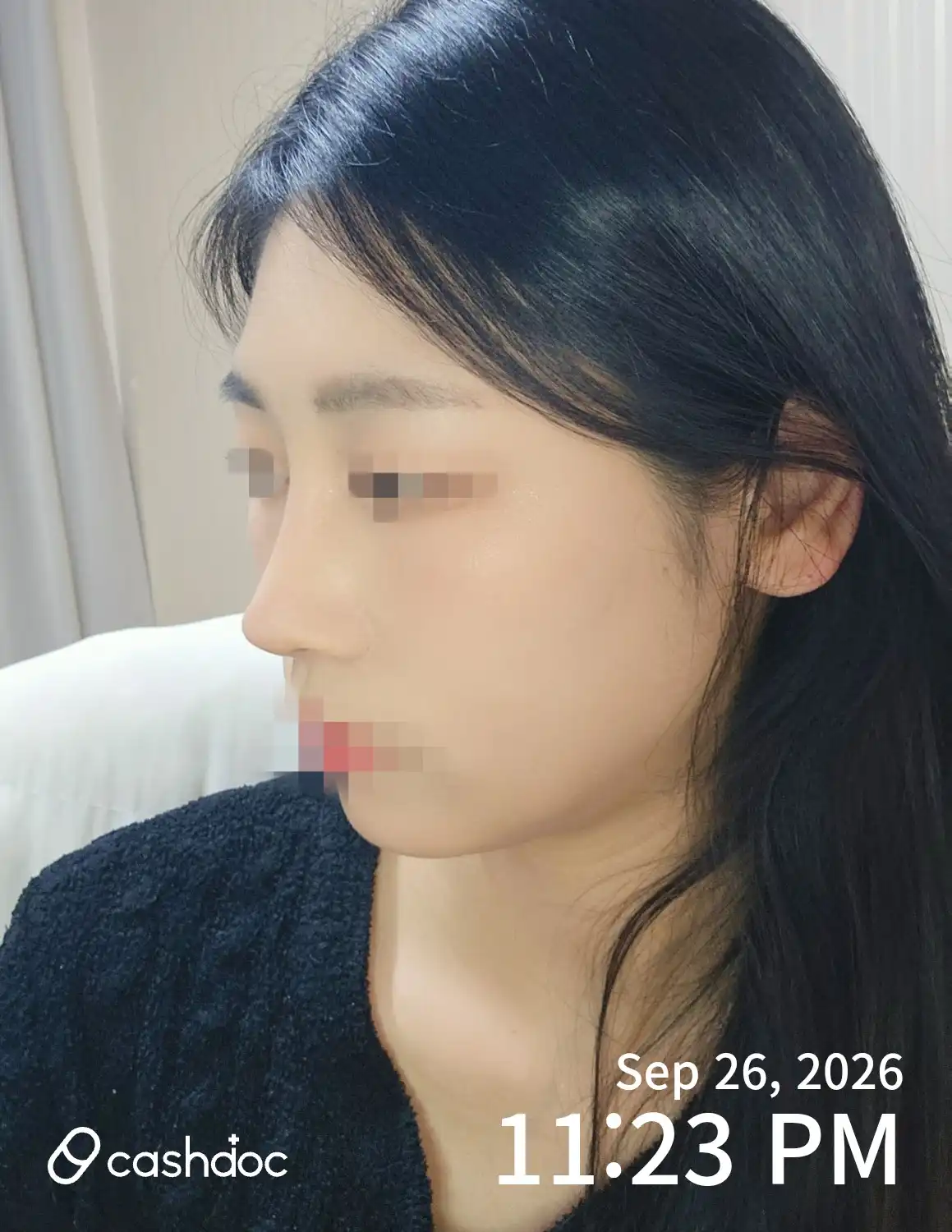 レビュー写真