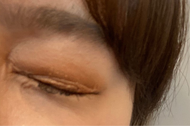 후