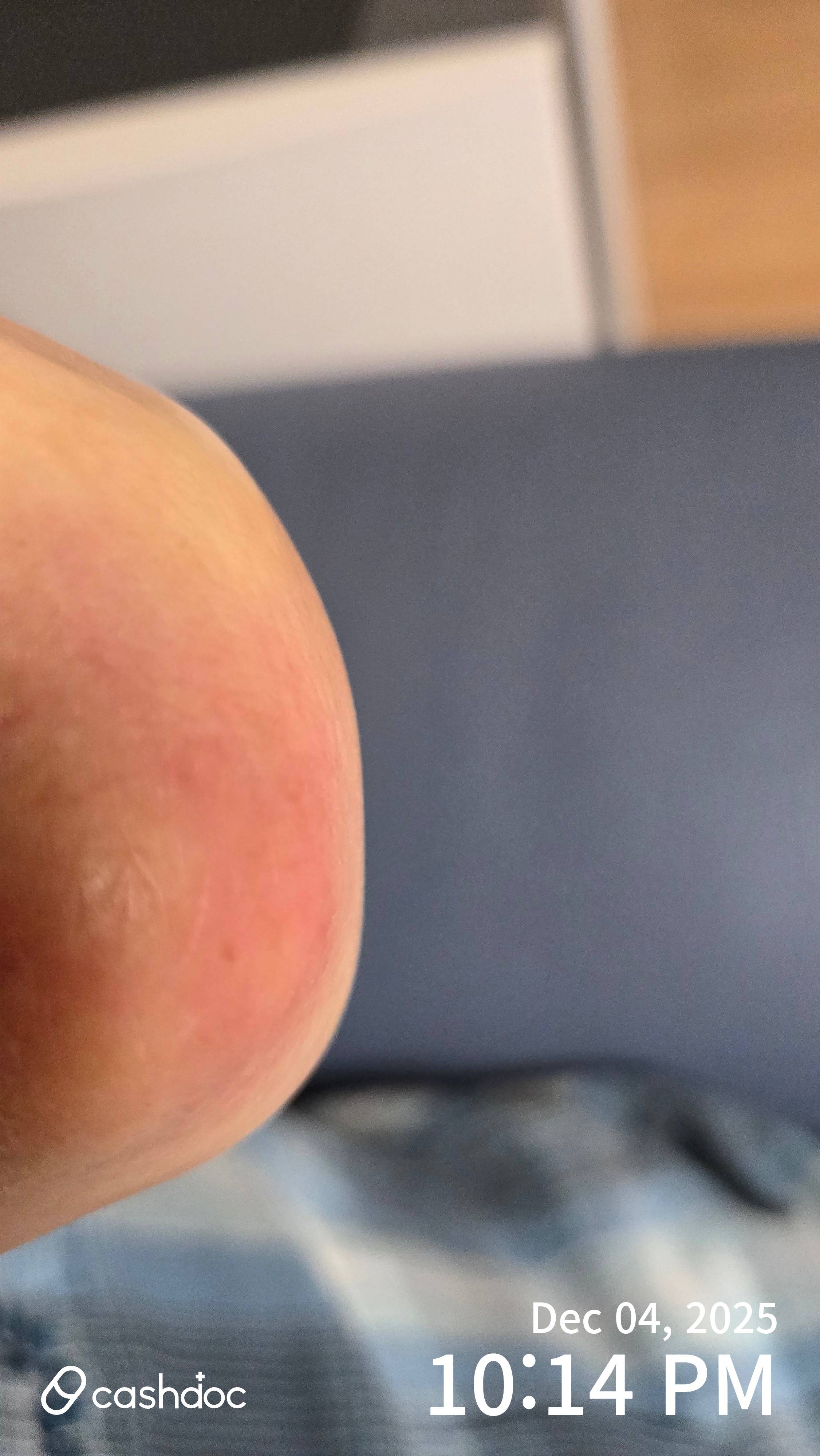 CNP차앤박피부과의원에서 편하게 피부 관리 받고 있어요