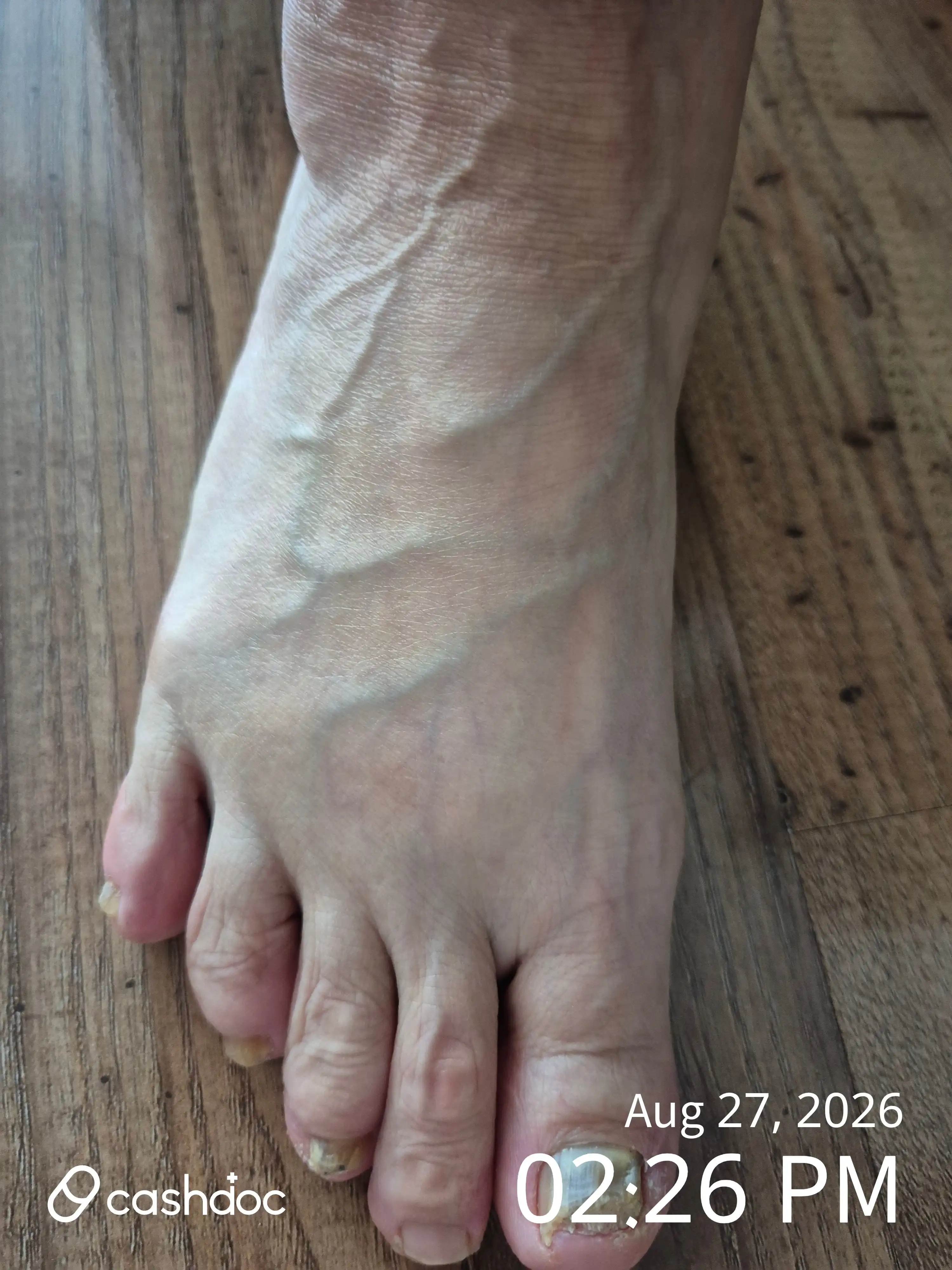 Review photo