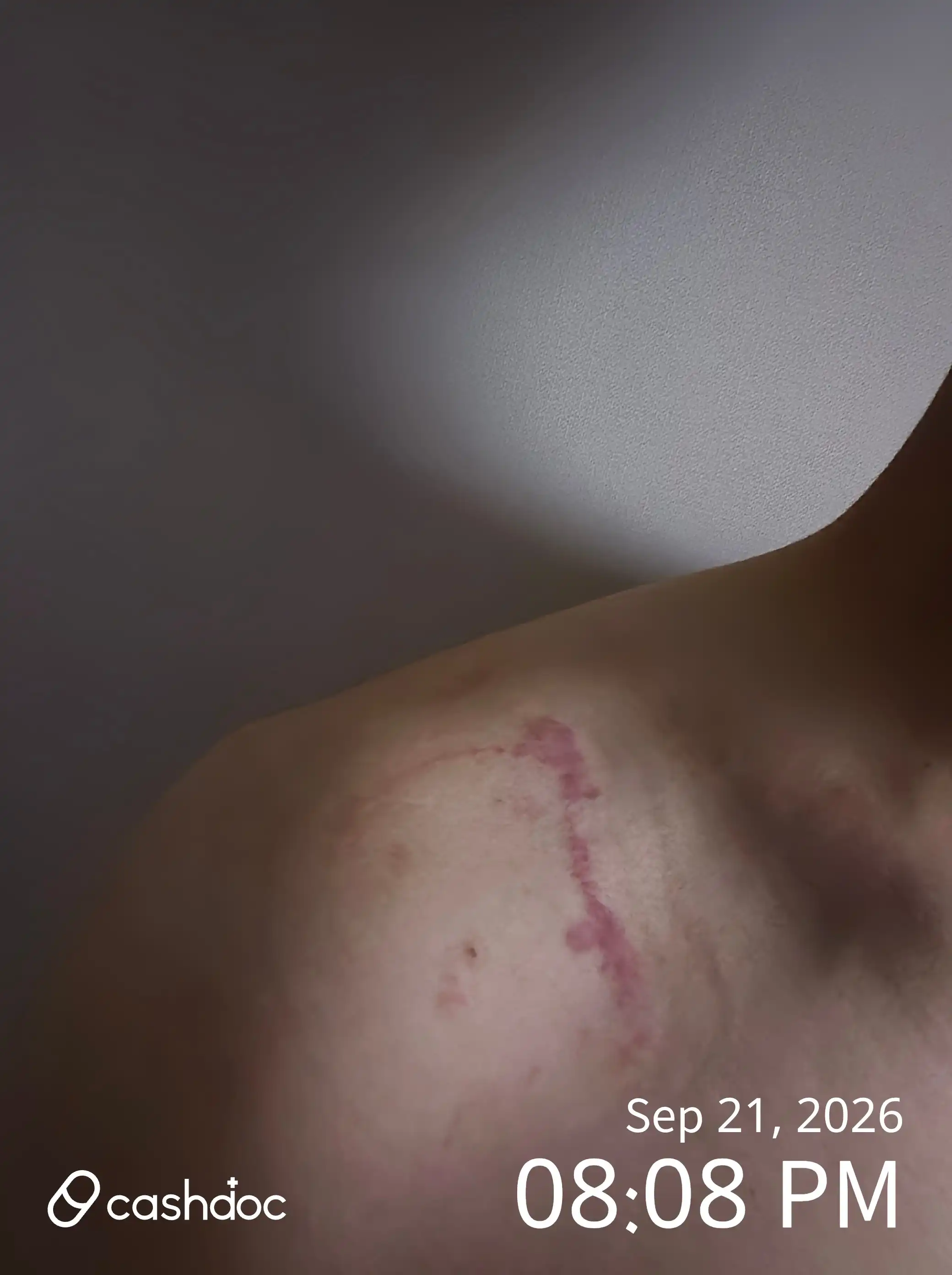 Review photo