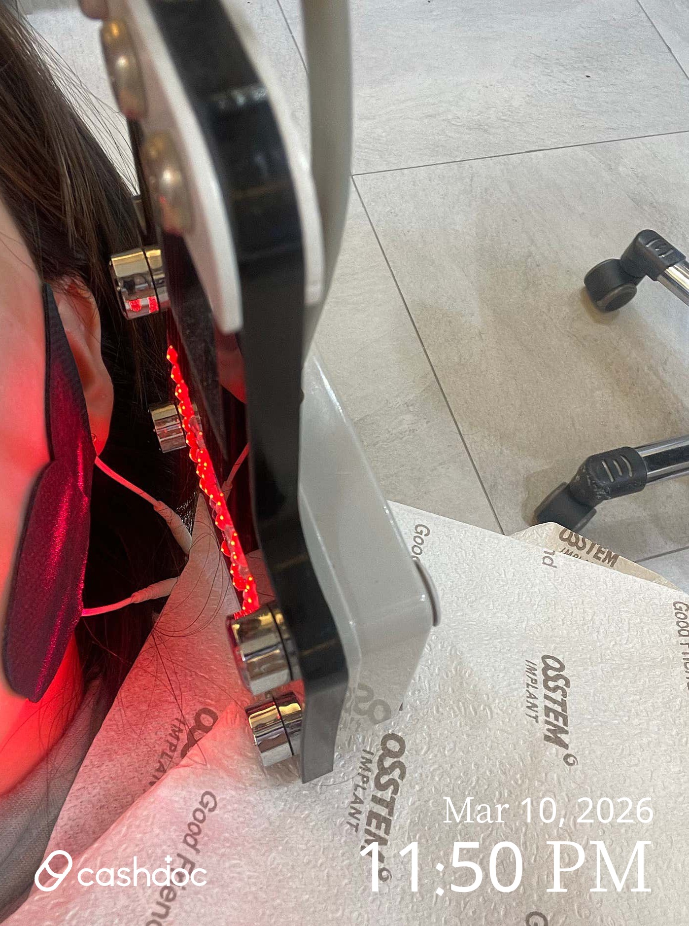 성남시 위례탑치과의원, 불편한 이갈이 장치 바로 조치받아요