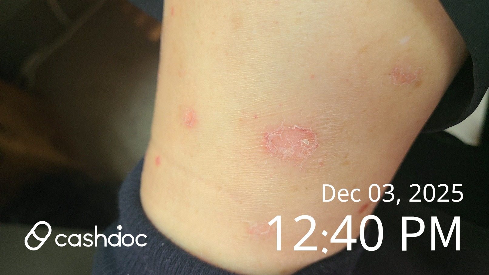 세종제이피부과의원 방문 후기 - 친절하고 깨끗한 병원 환경