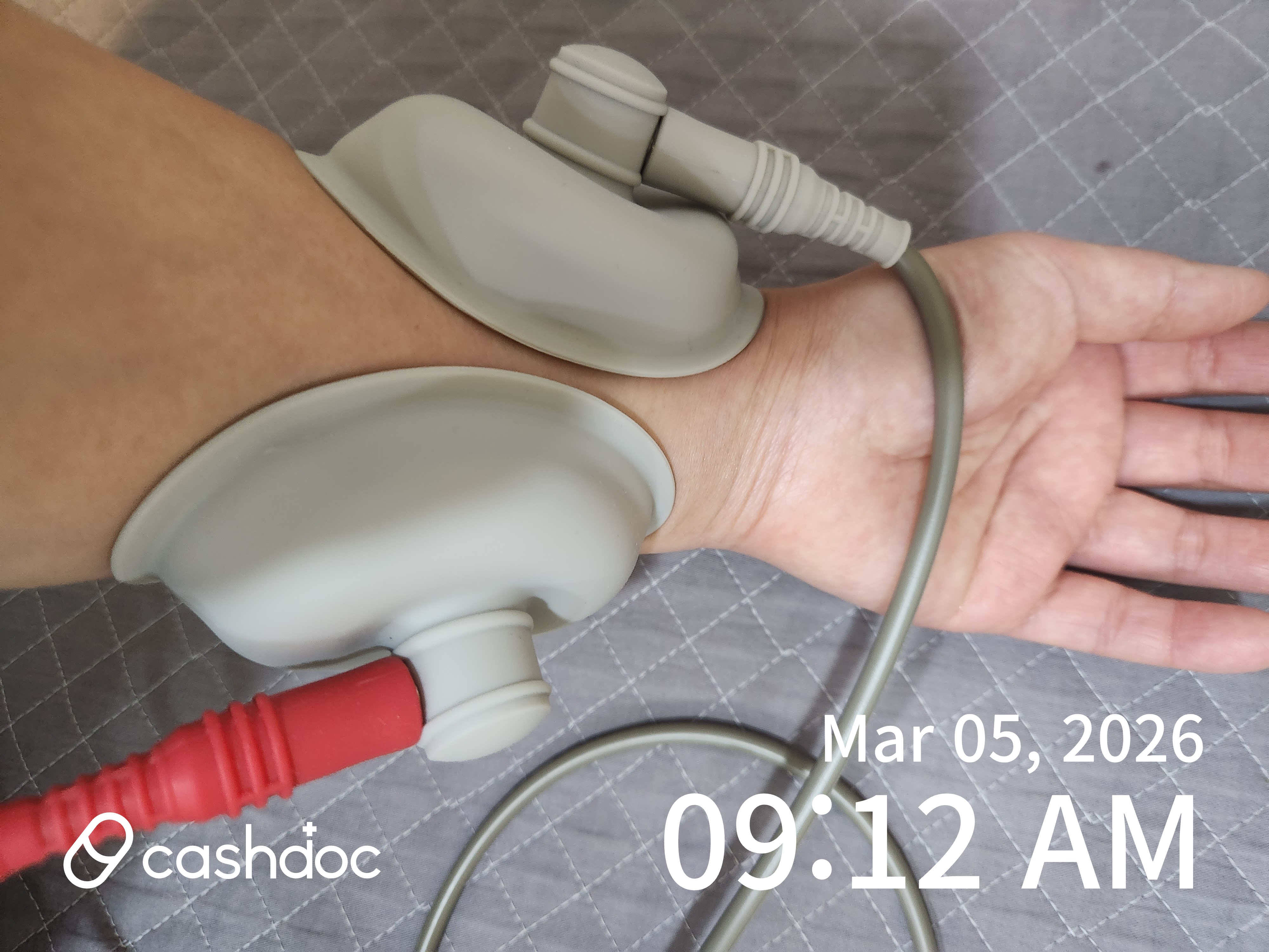 솔한의원 안성시에서 손가락 통증, 테니스 엘보까지 침 치료 좋아요