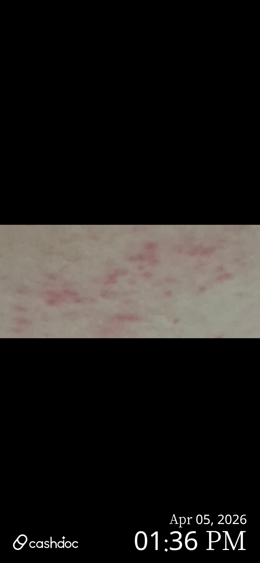 전주시 수경피부과의원 대기시간, 좀 줄일 방법 없을까요?