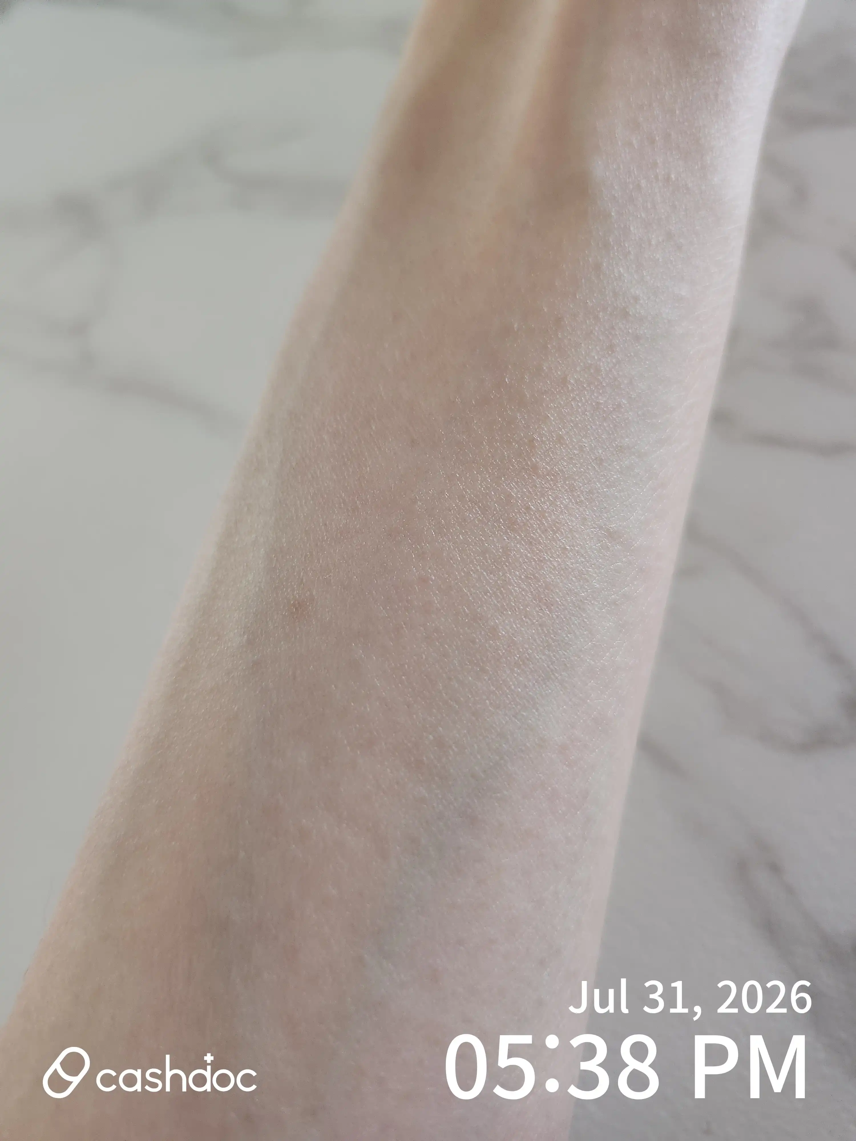 Review photo