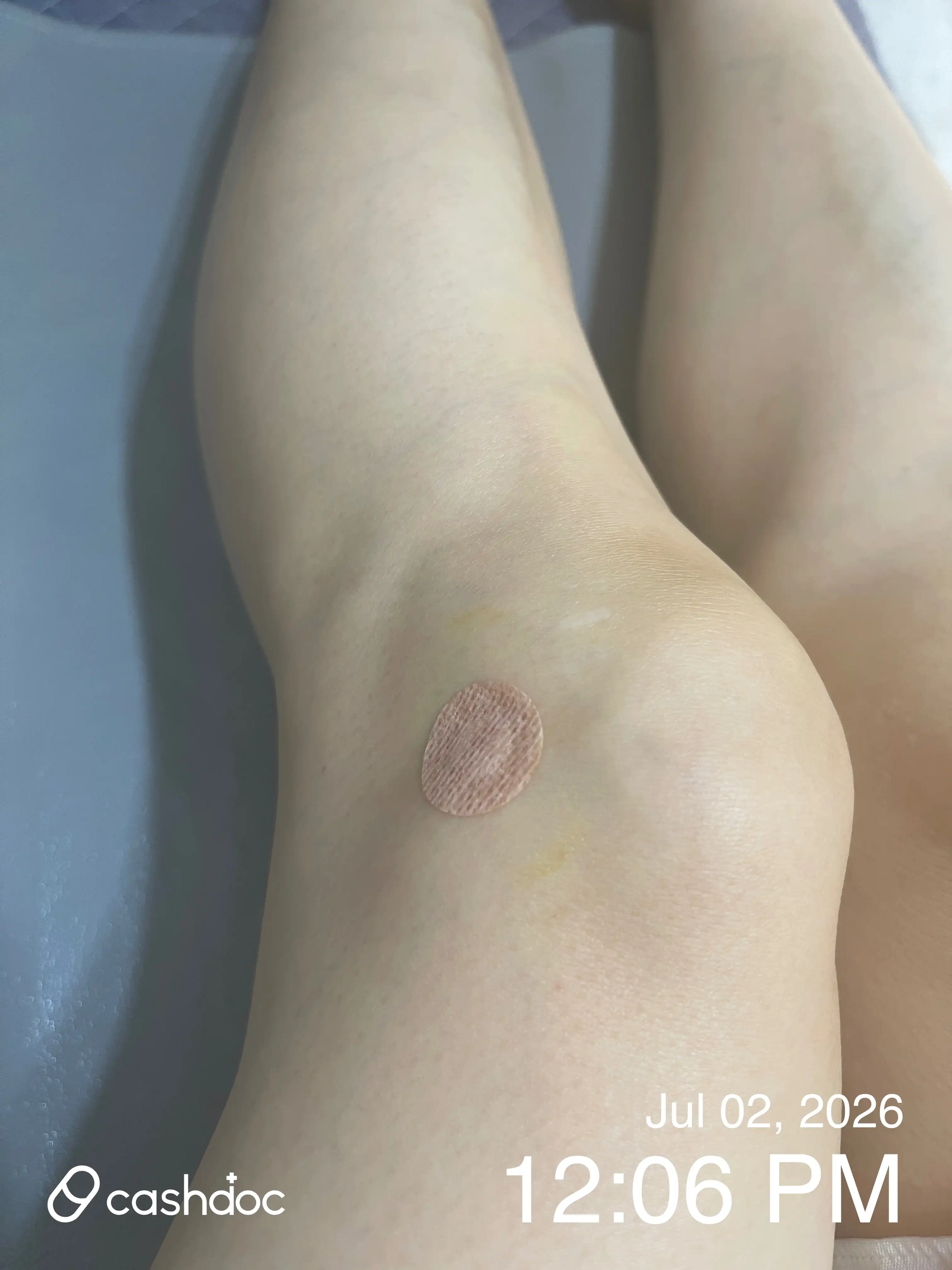 评价照片