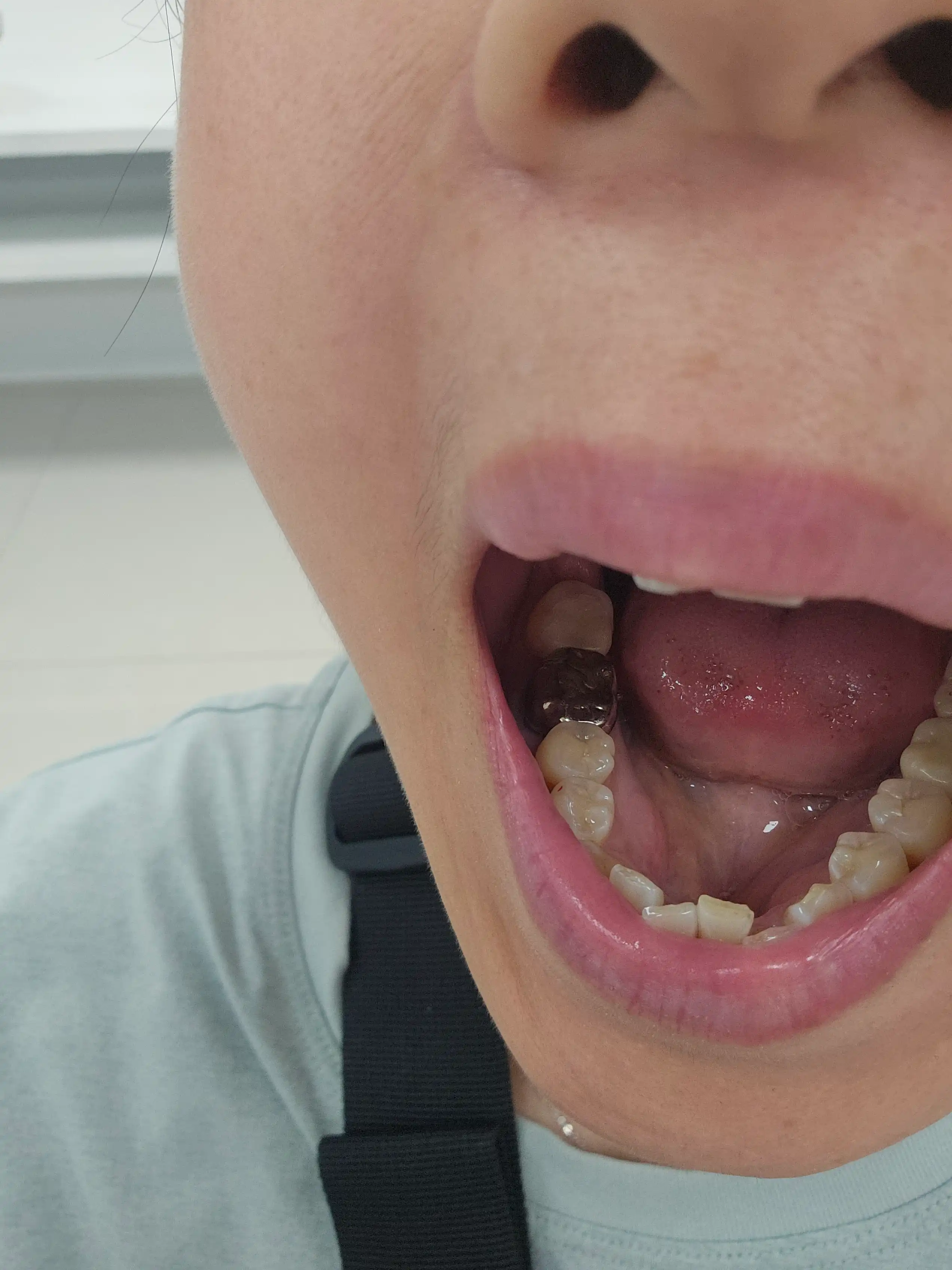 Review photo