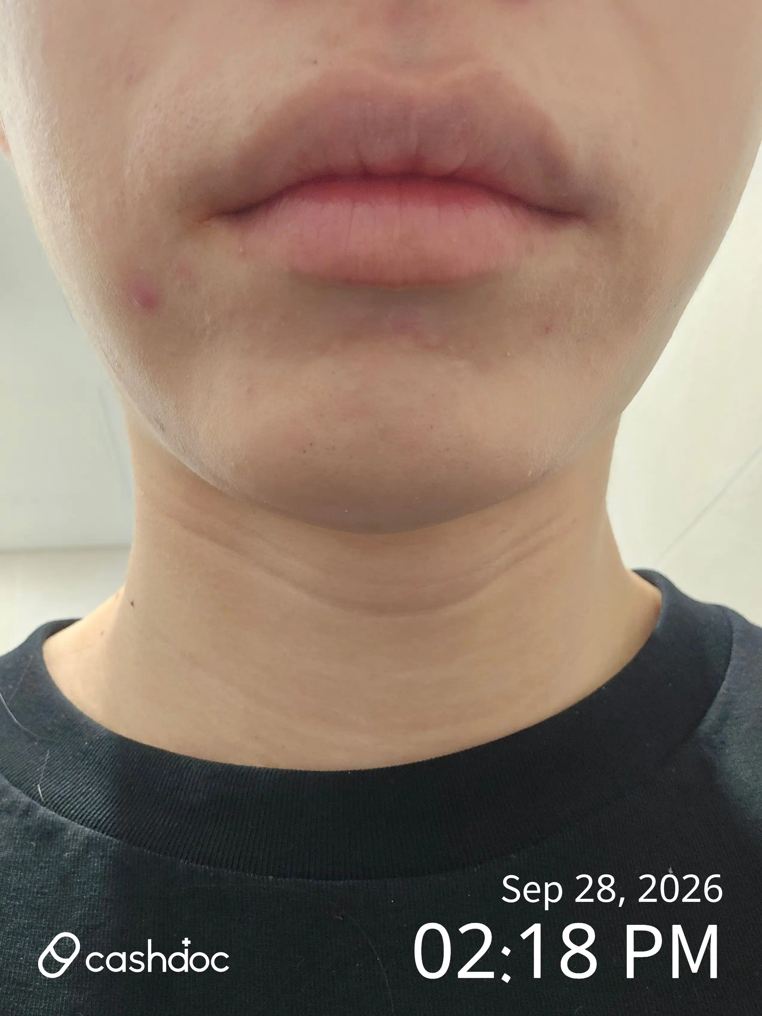 评价照片