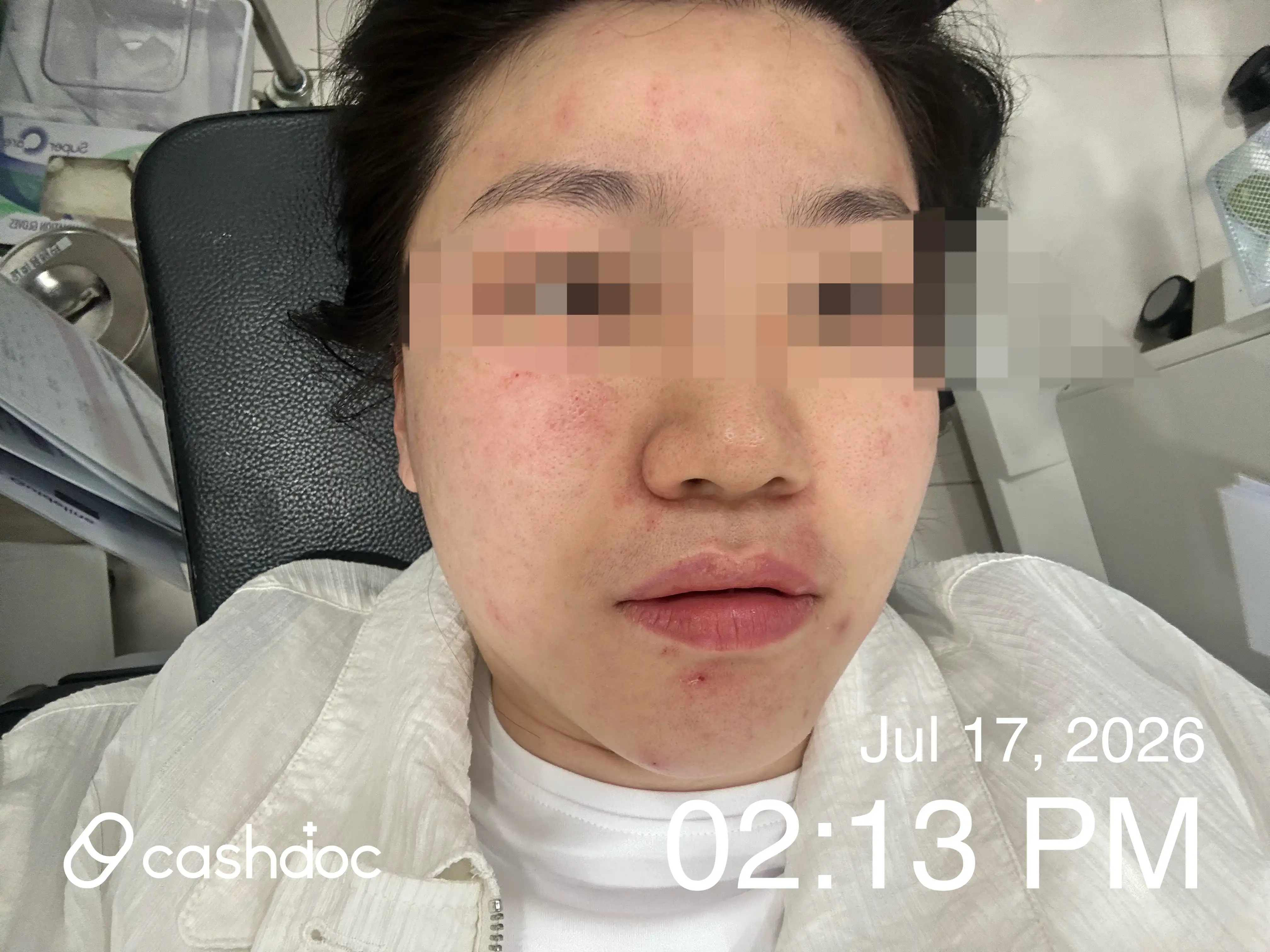 Review photo
