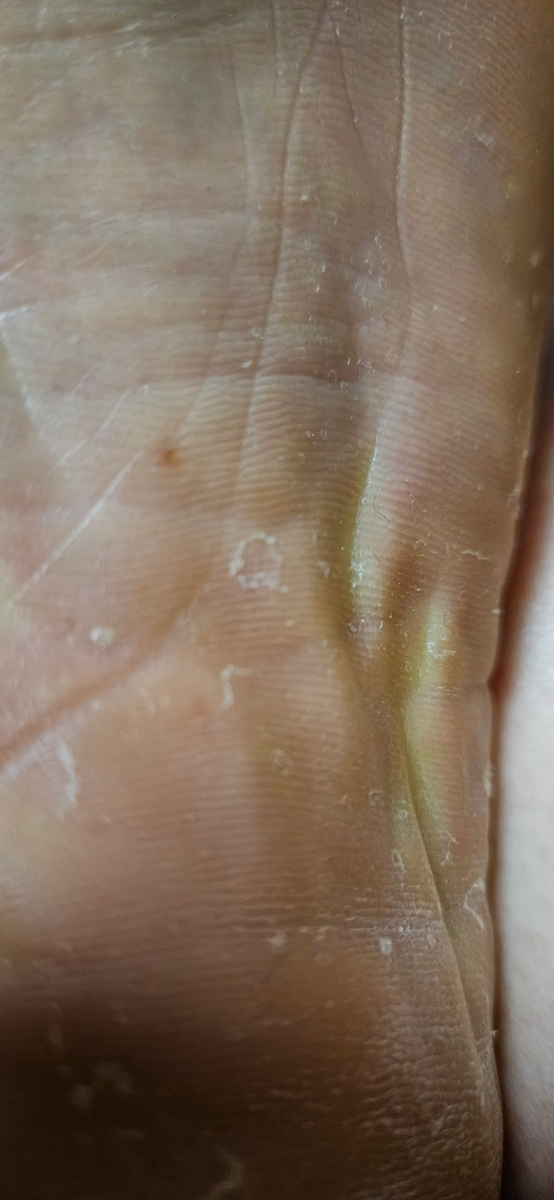 评价照片