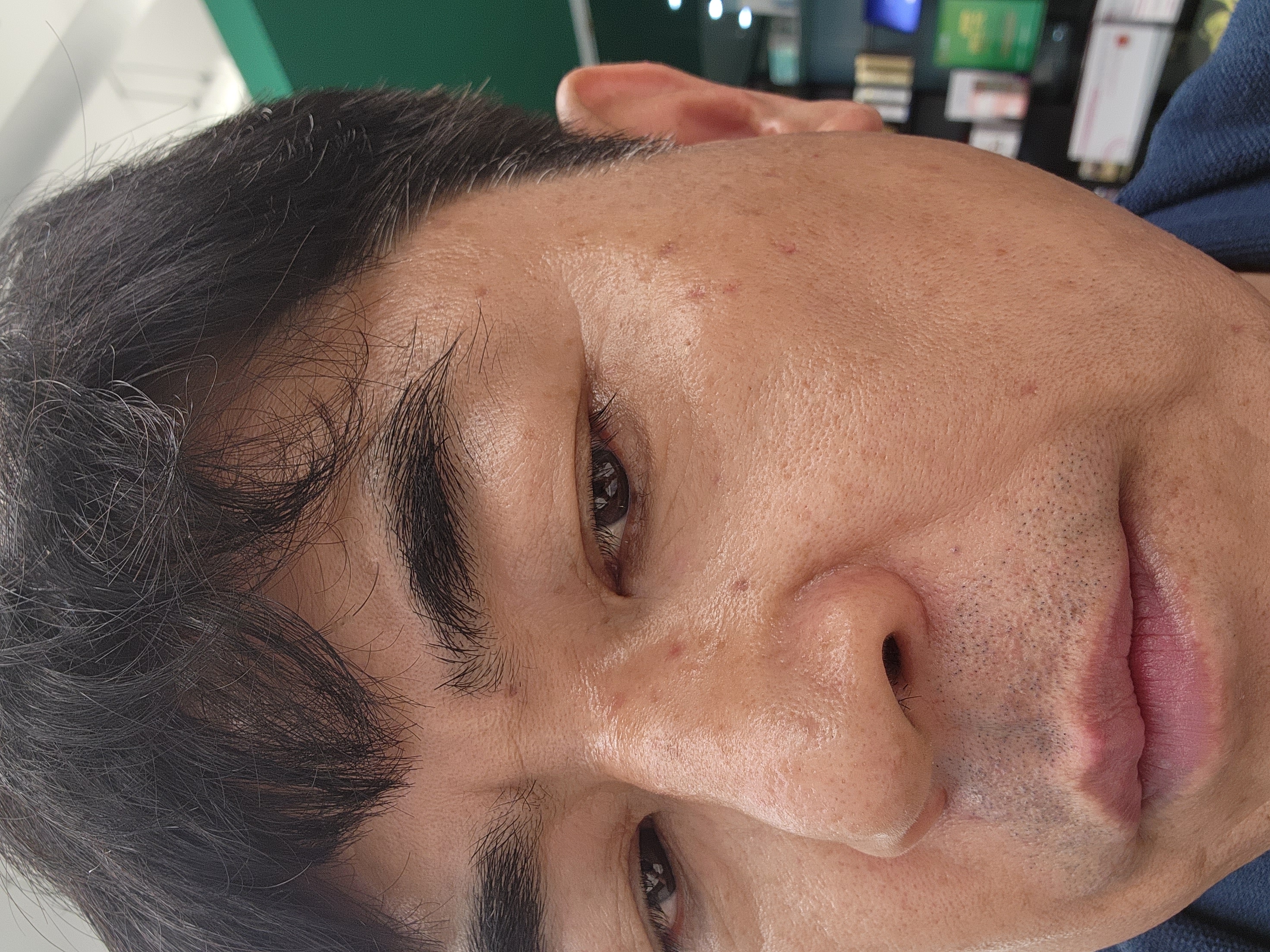 After