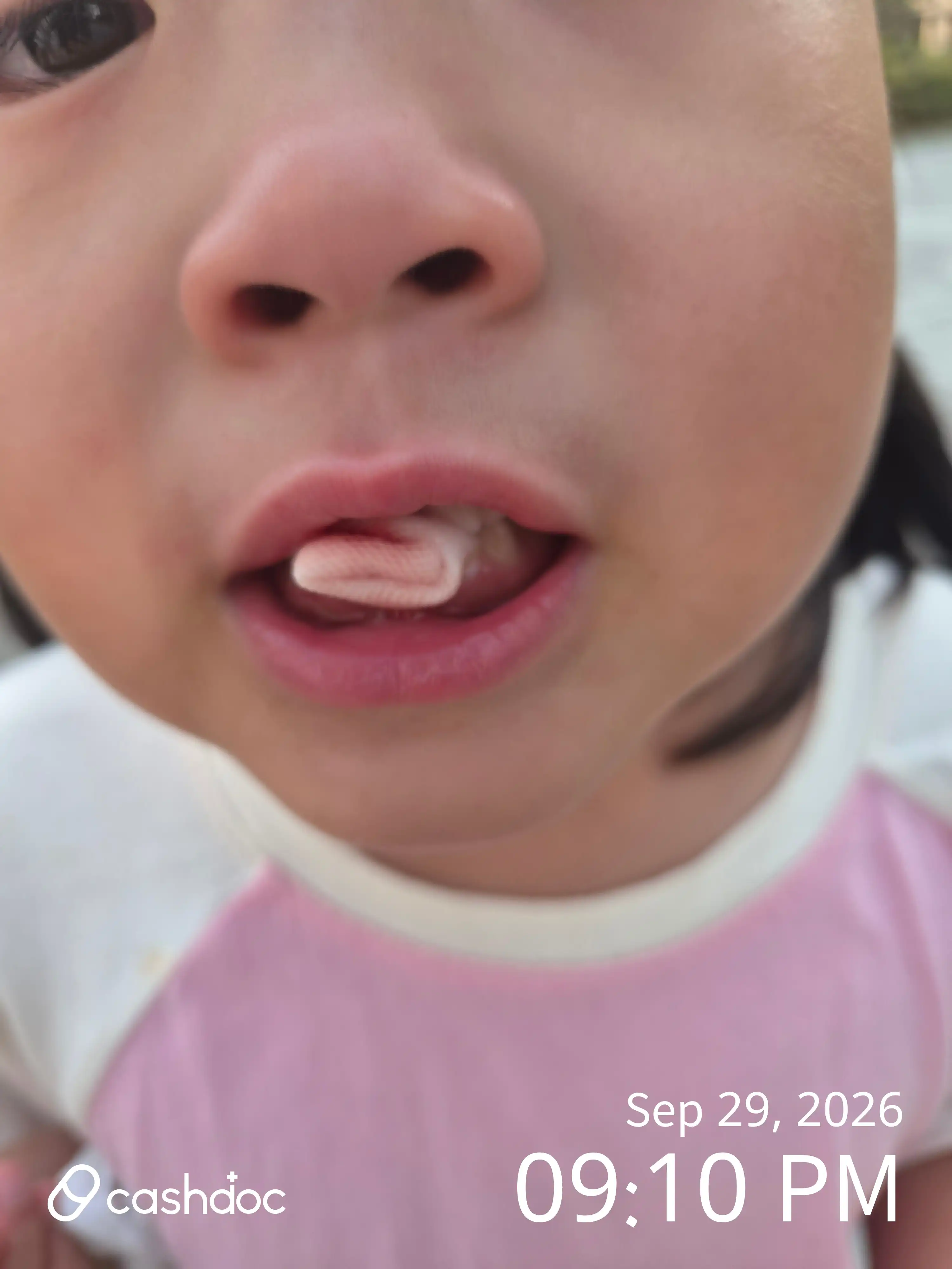 Review photo