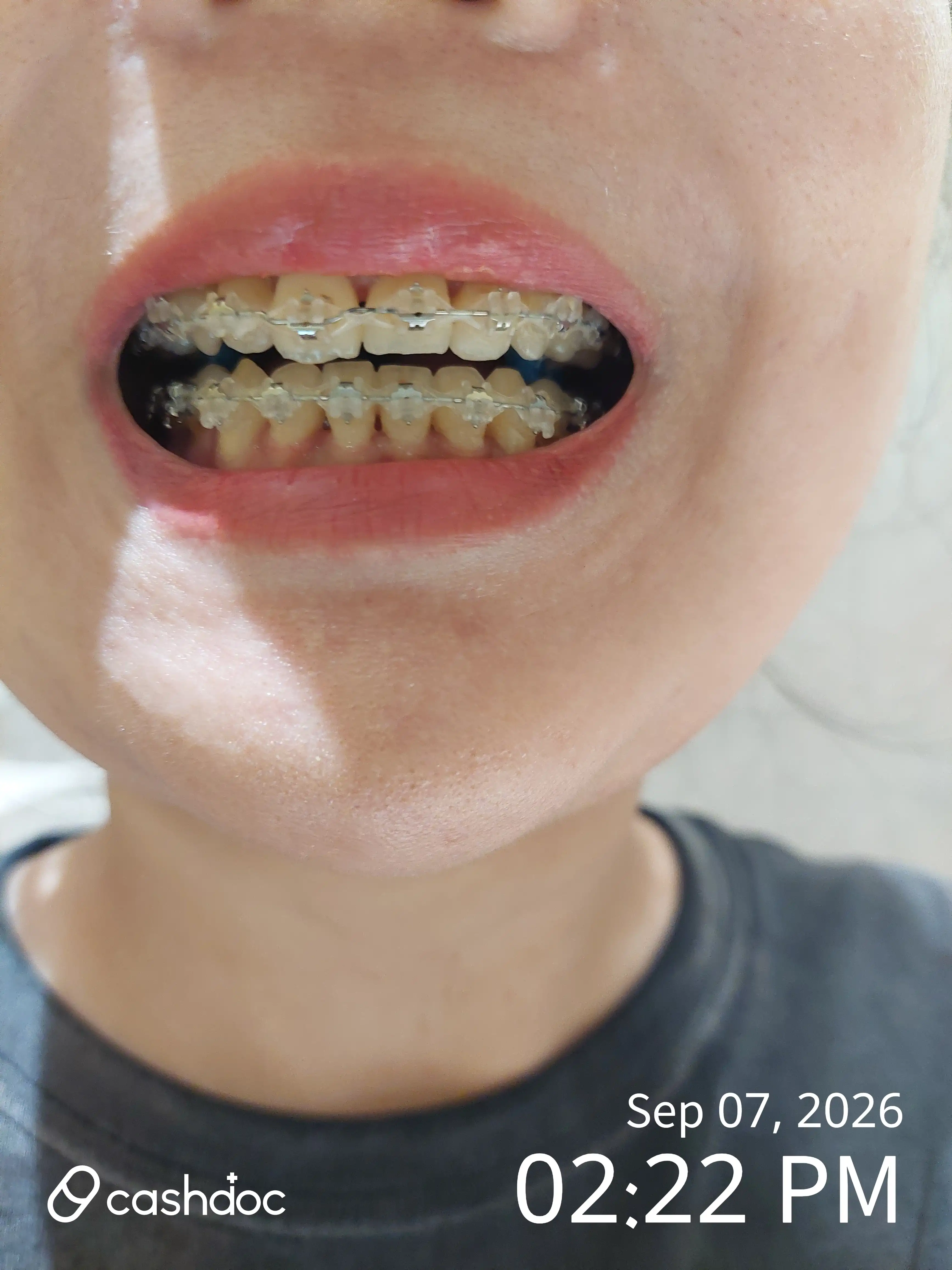 Review photo