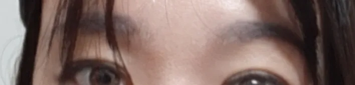 시술 전 — 초간편 반영구 패키지