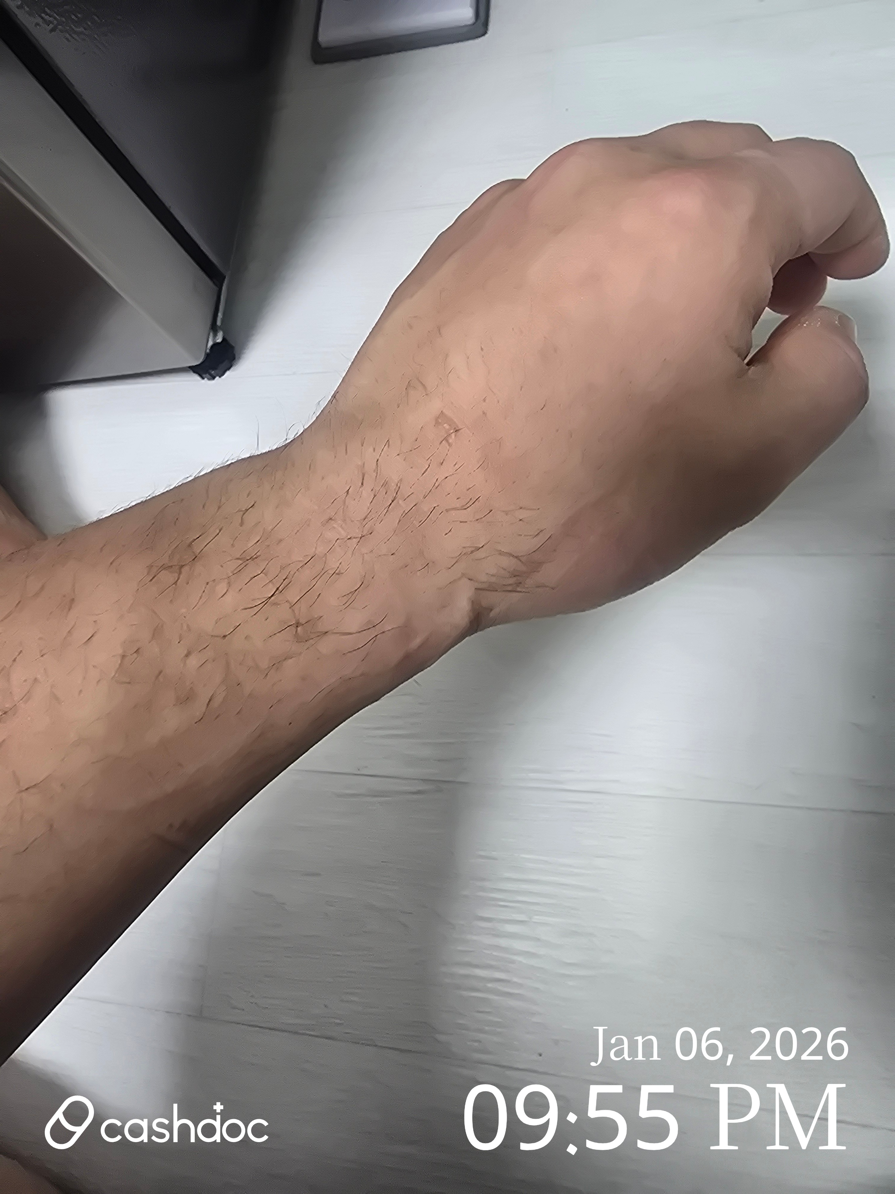 평택시 현대정형외과의원, 손목 통증 완화 잘해줘요