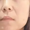 後