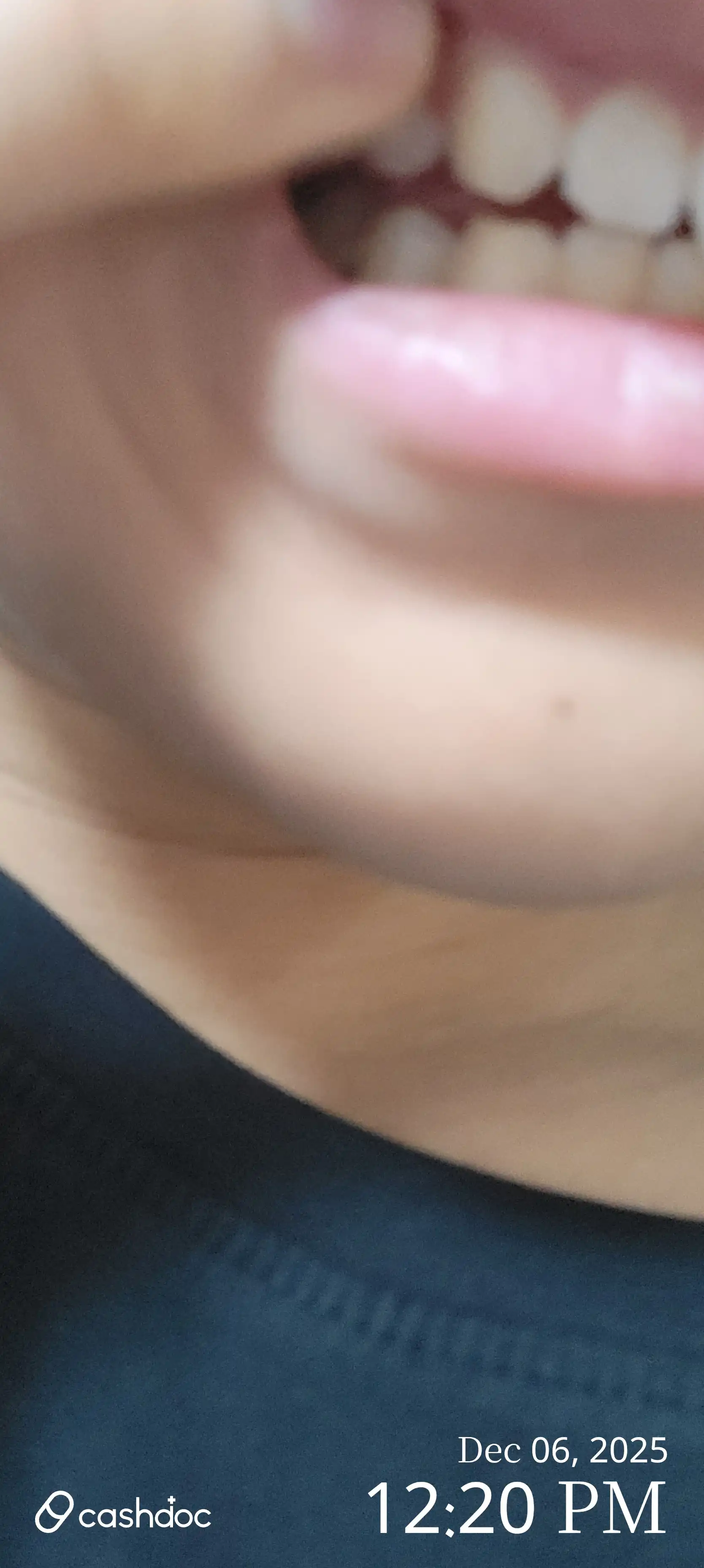 评价照片