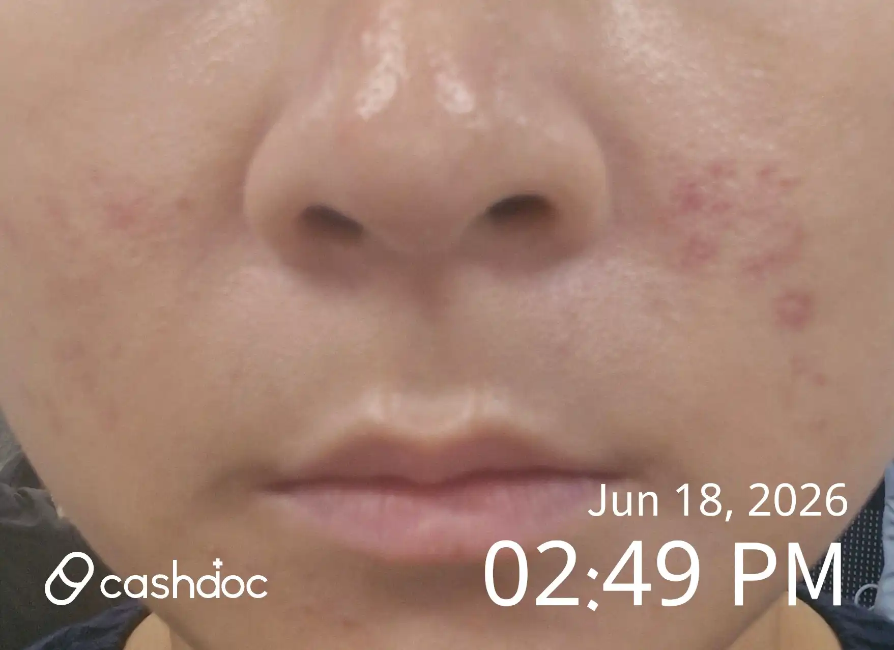 Review photo
