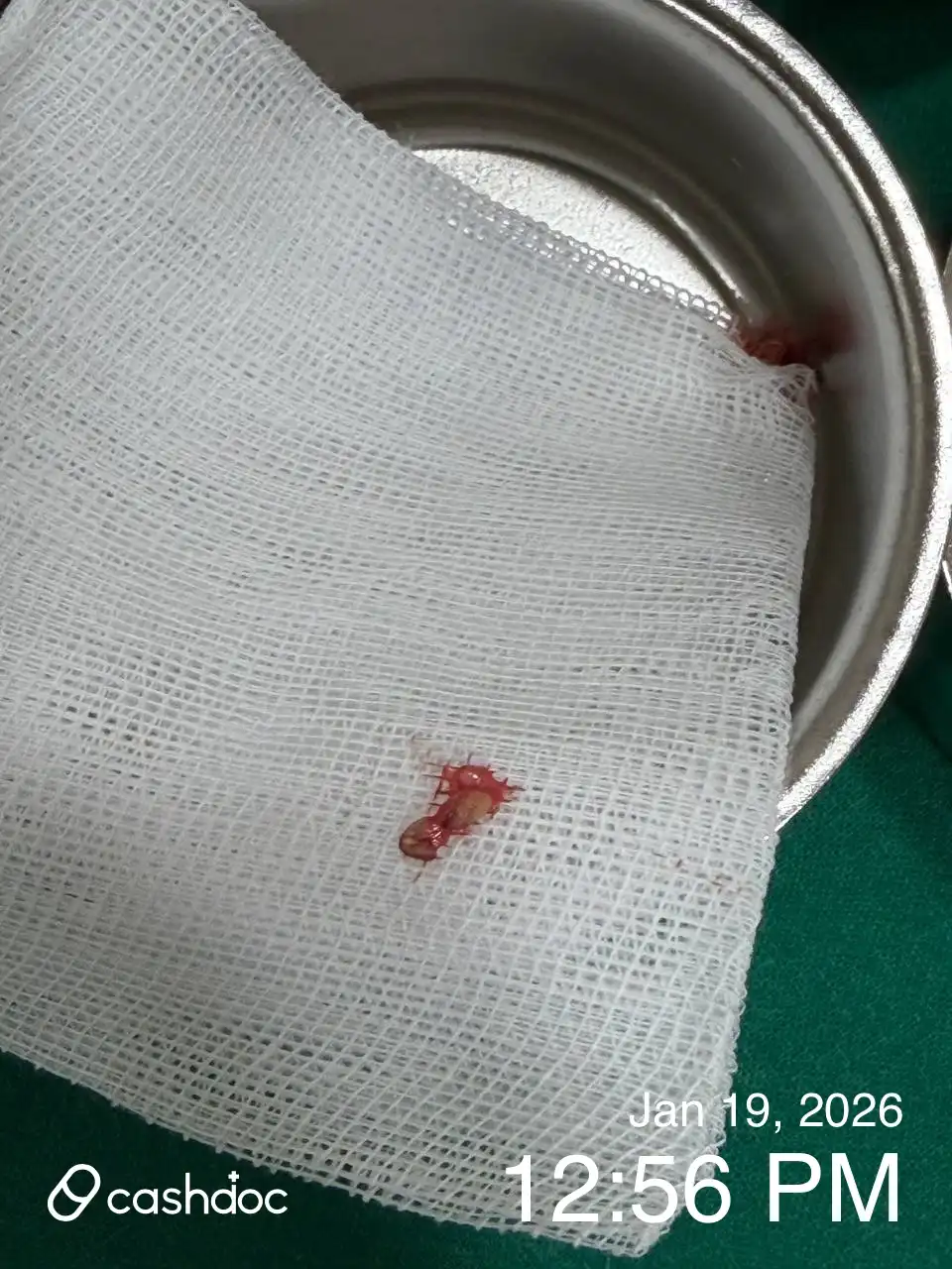 리뷰 사진 1
