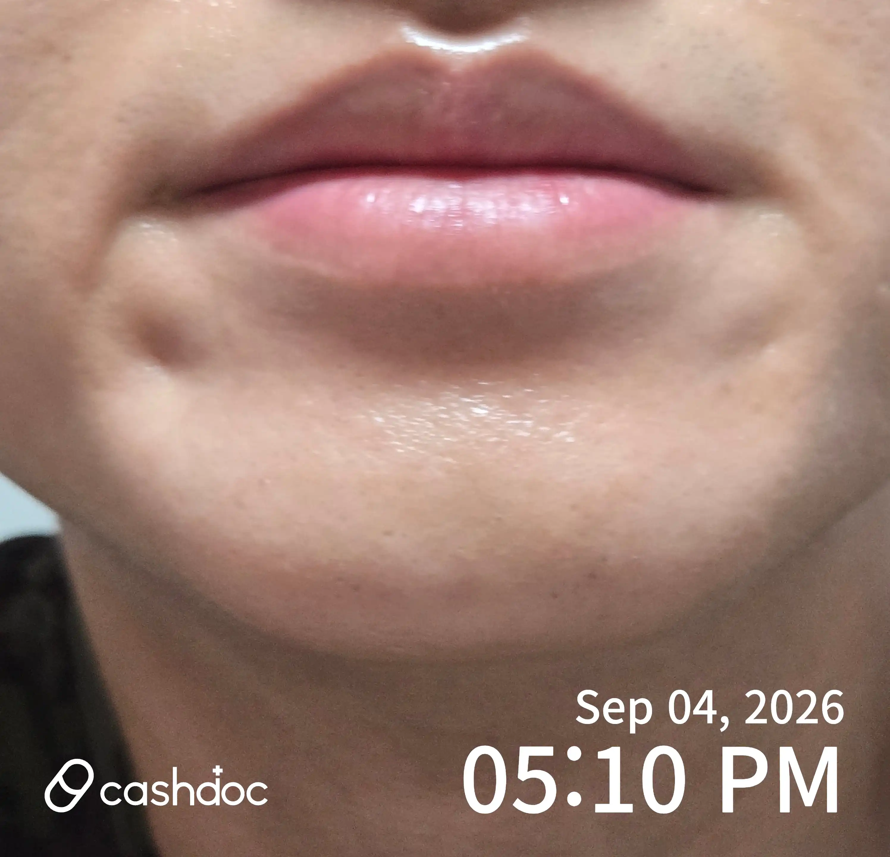 Review photo