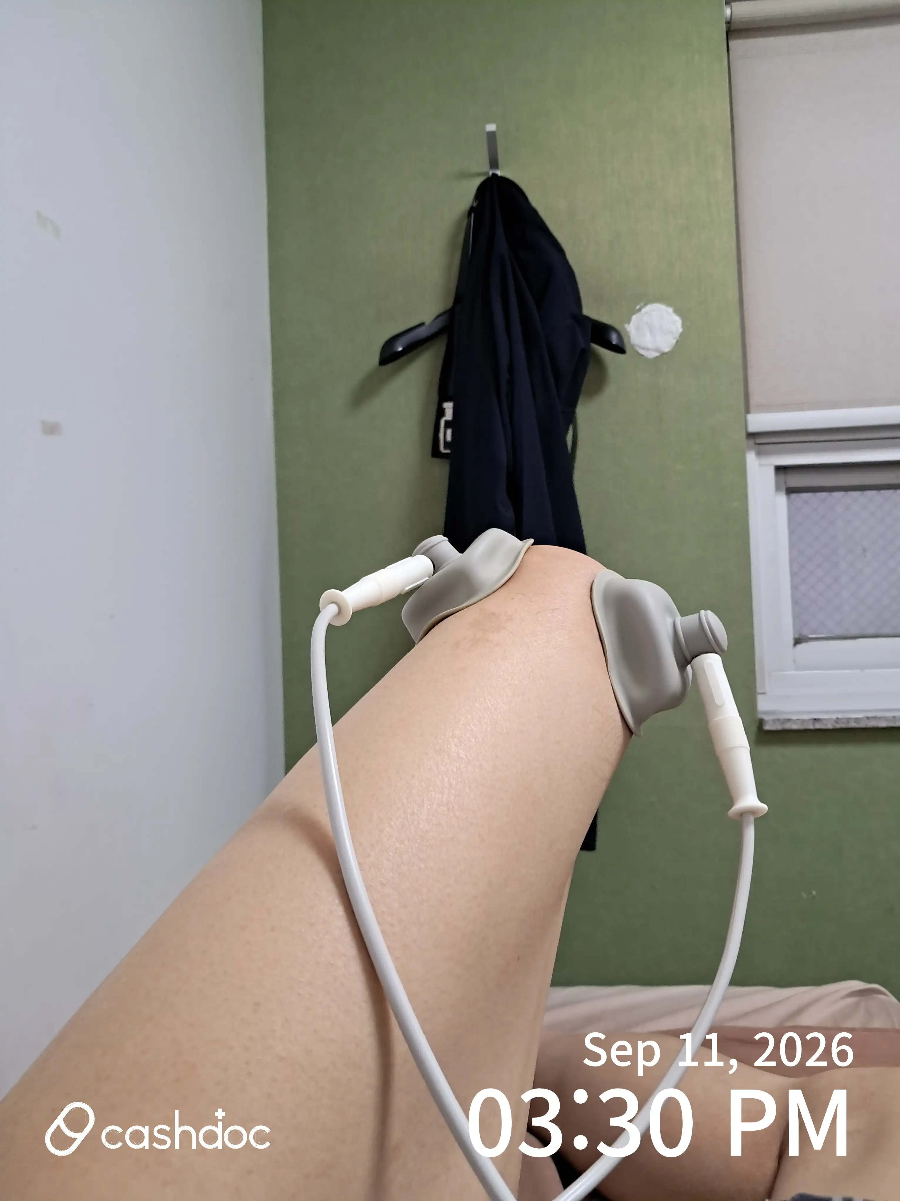 Review photo