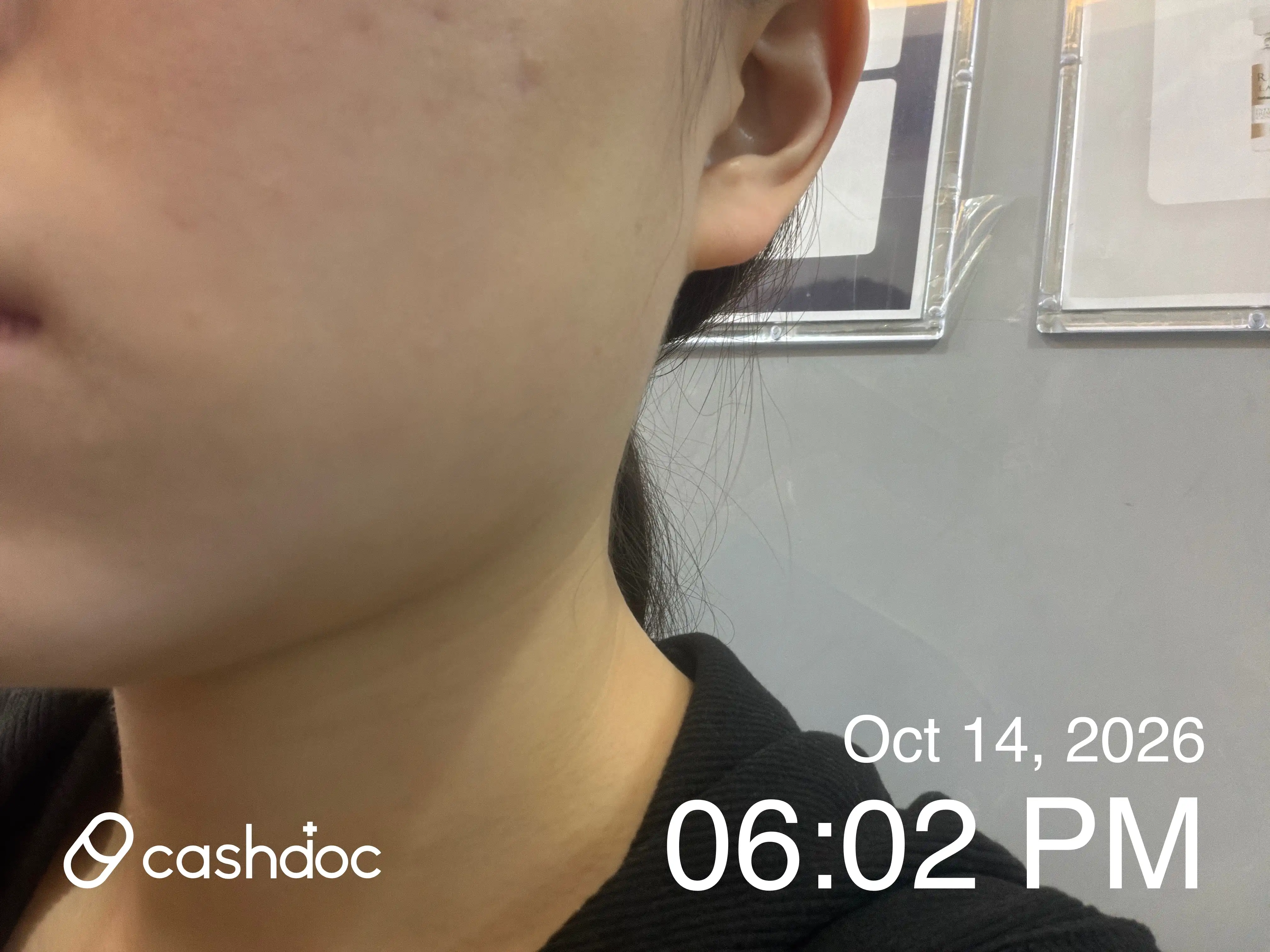 Review photo